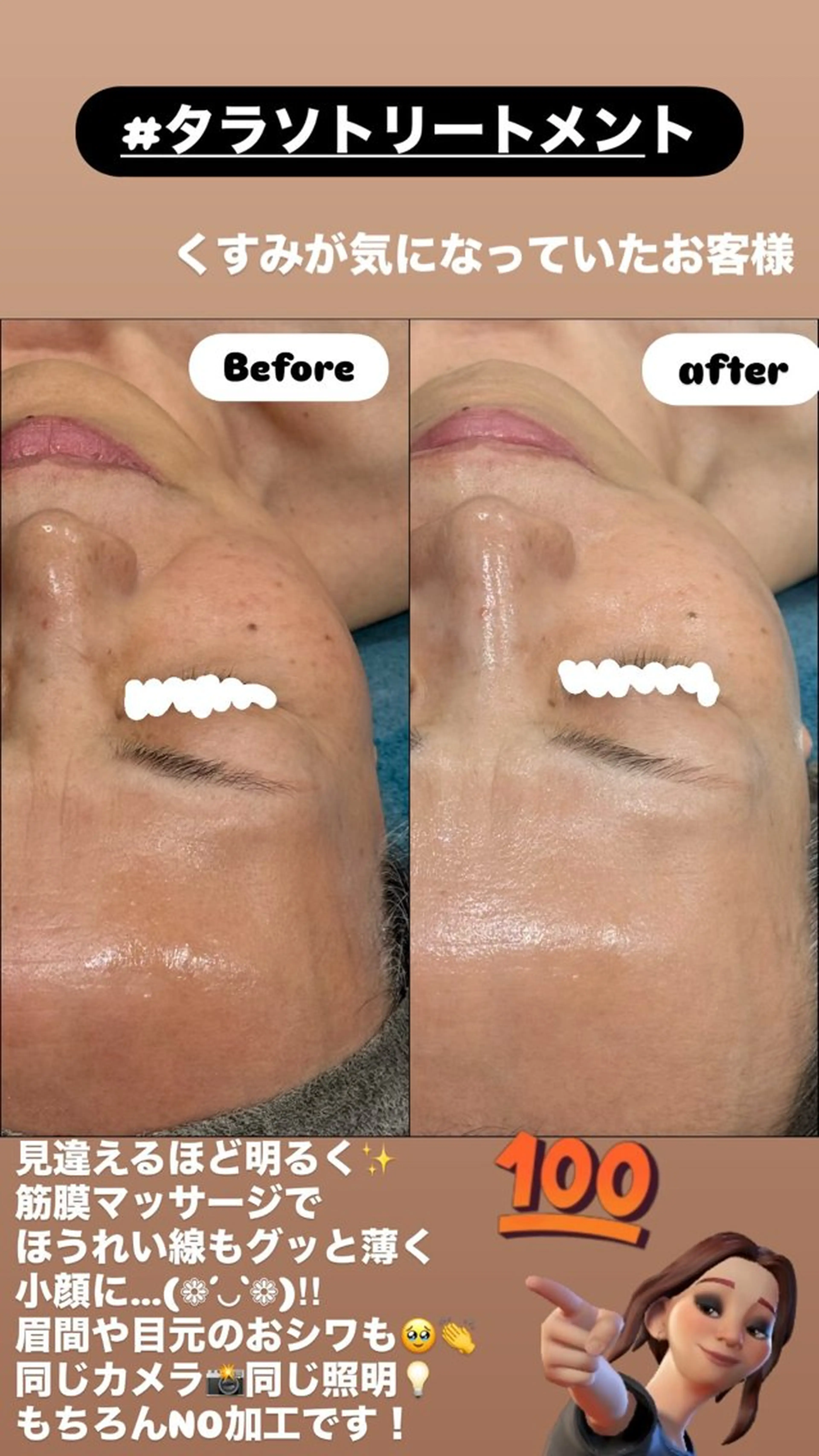 エステ LiZA エステティックサロンのエステ・リラクイメージ