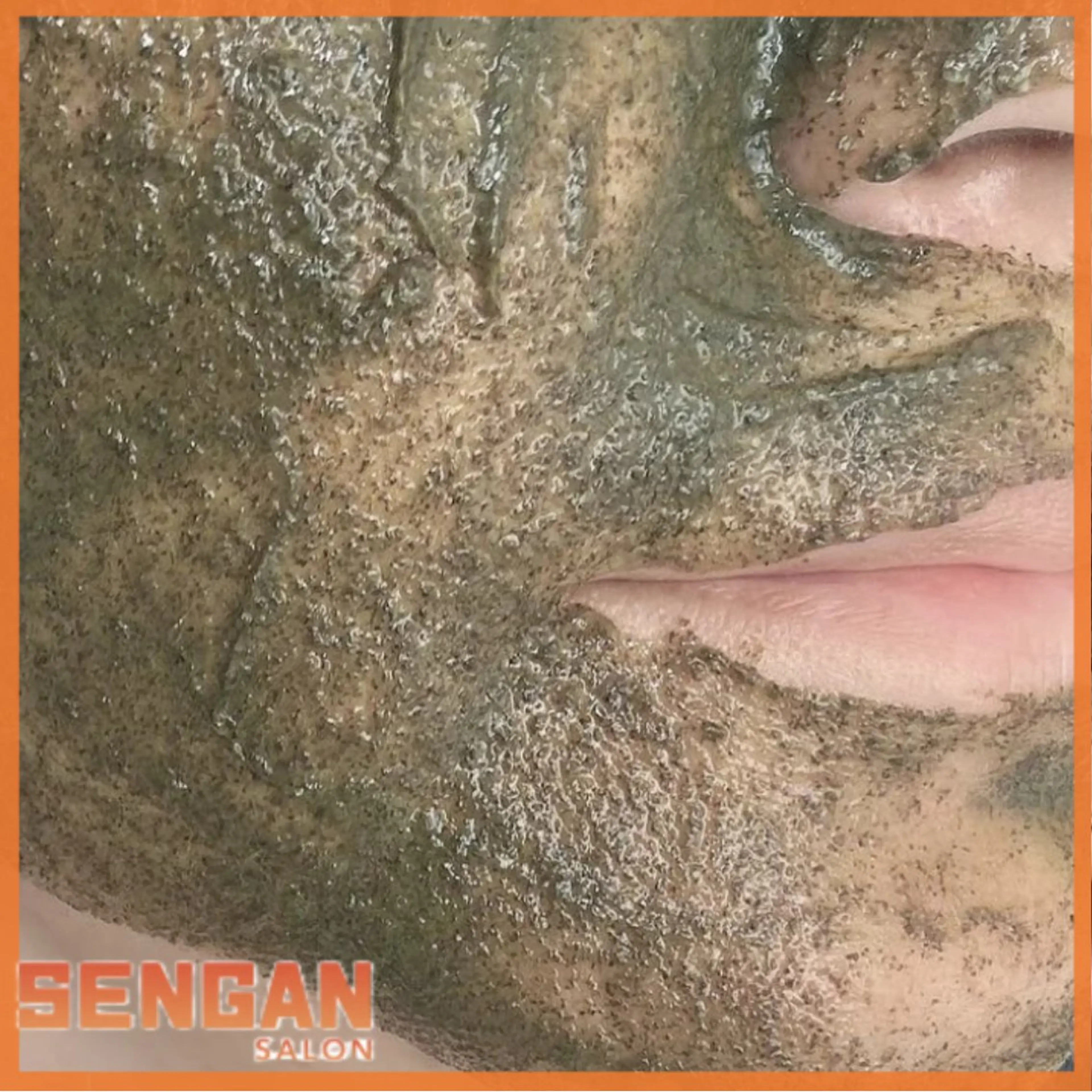 エステ 洗顔サロン池袋 毛穴洗浄のその他イメージ