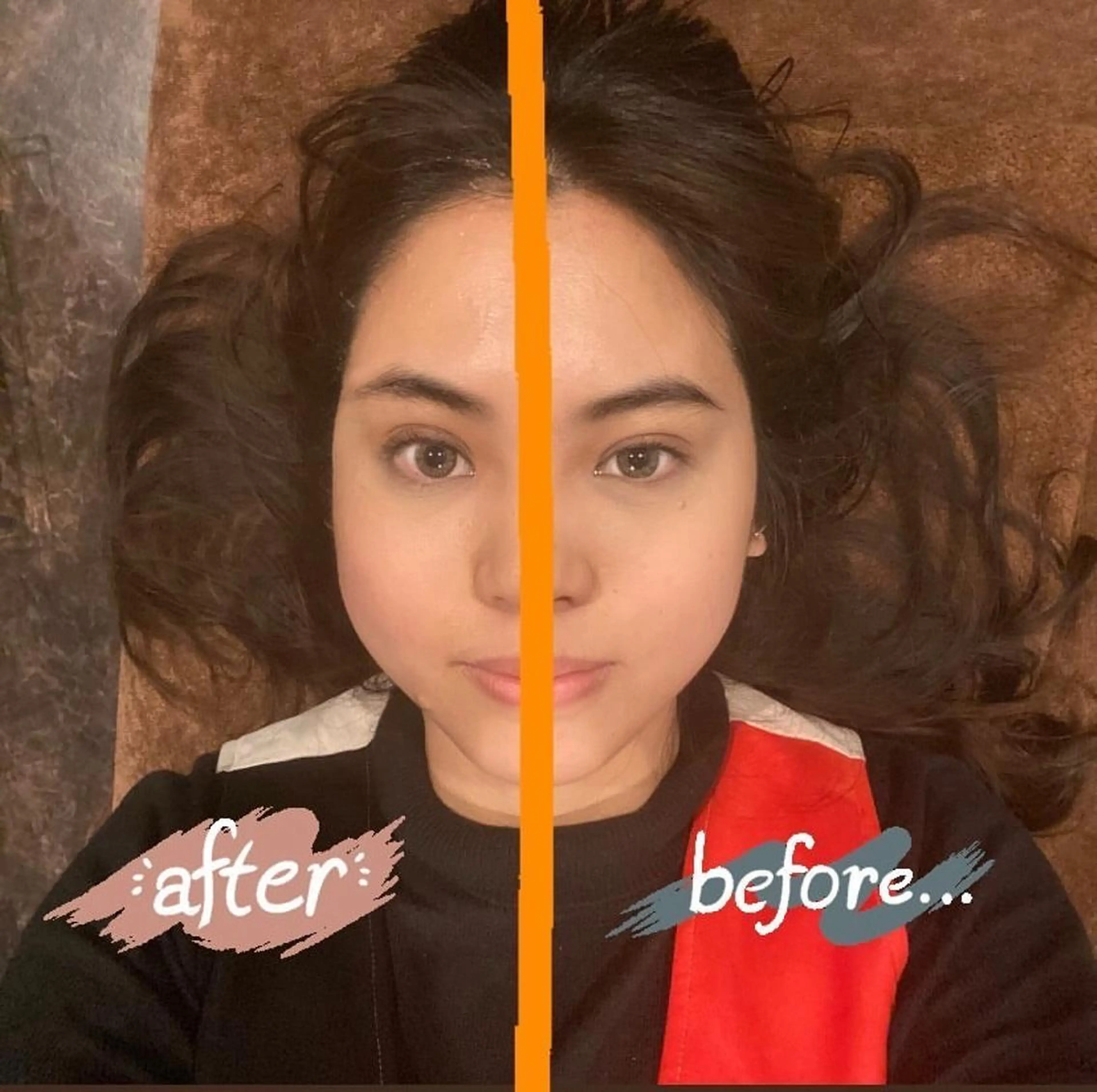 美容鍼灸サロン LOMIHARIのエステ・リラクイメージ