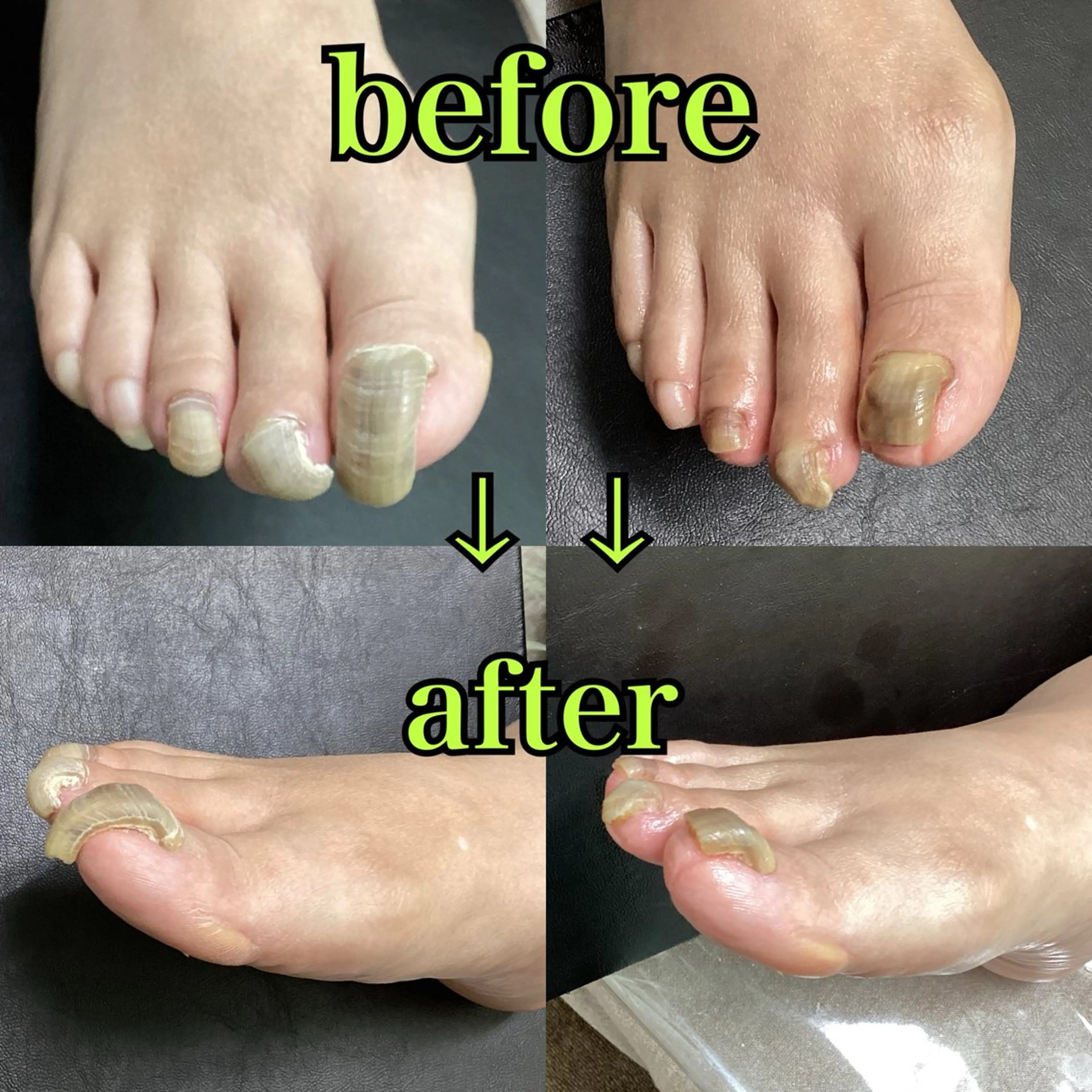 ネイル フットネイル ヒューマン 鍼灸接骨院所属・リラク/ヘッドスパ/ 足裏ケア/蛭川栞のエステ・リラクイメージ