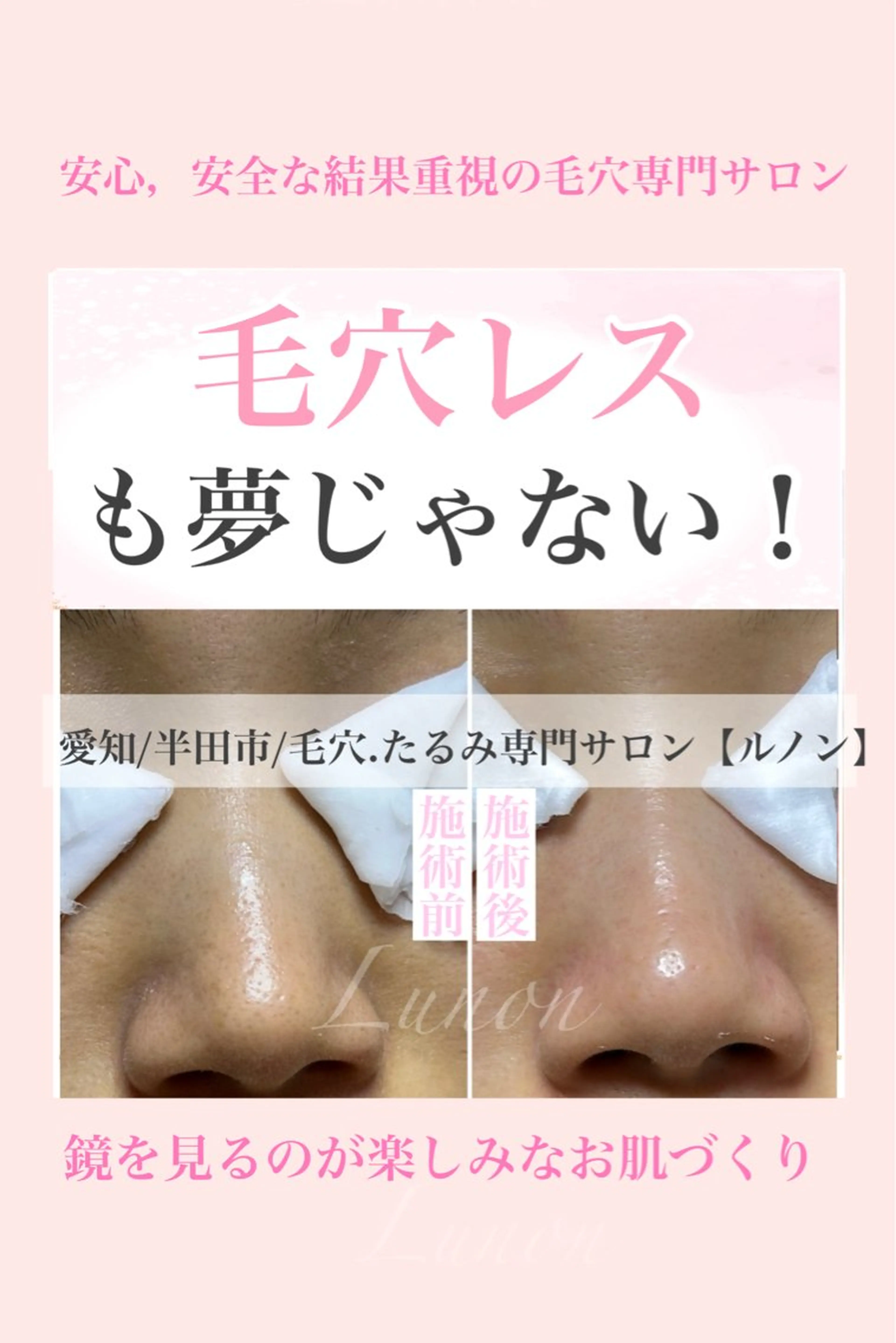 エステ リラク 毛穴.たるみ専門店 Lunonのエステ・リラクイメージ