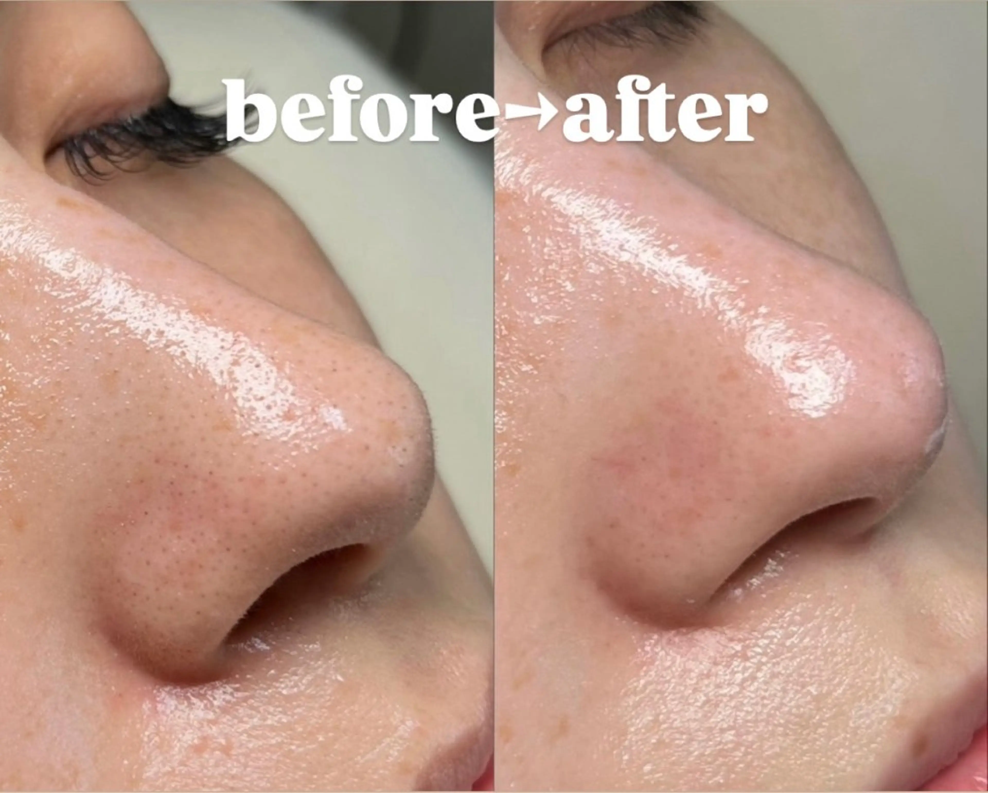 その他 Skincare Room〜Caaka〜所属・橋本 千寿のエステ・リラクイメージ