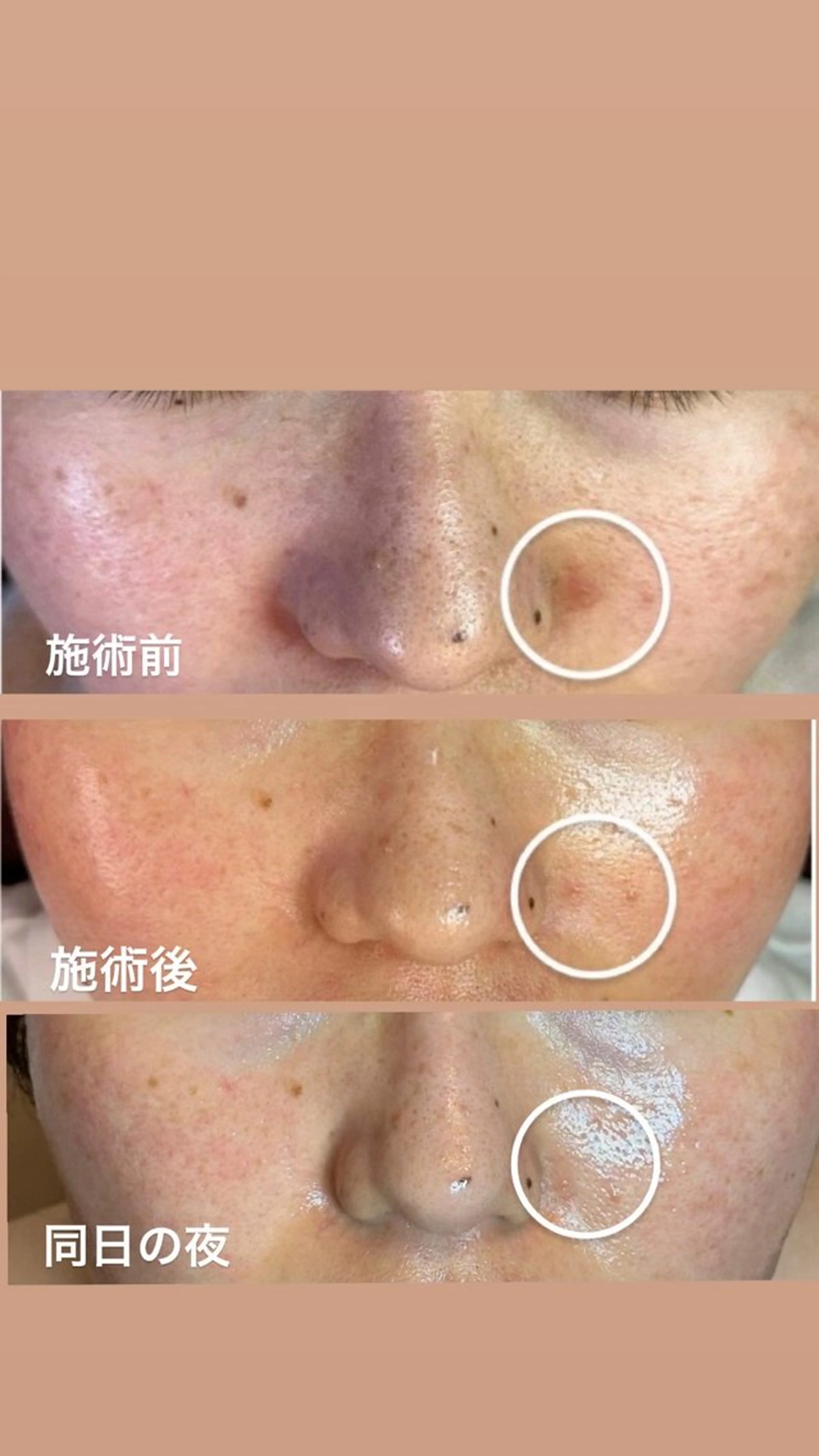 マツヤニWax専門/ 岸和田/Luanaのエステ・リラクイメージ