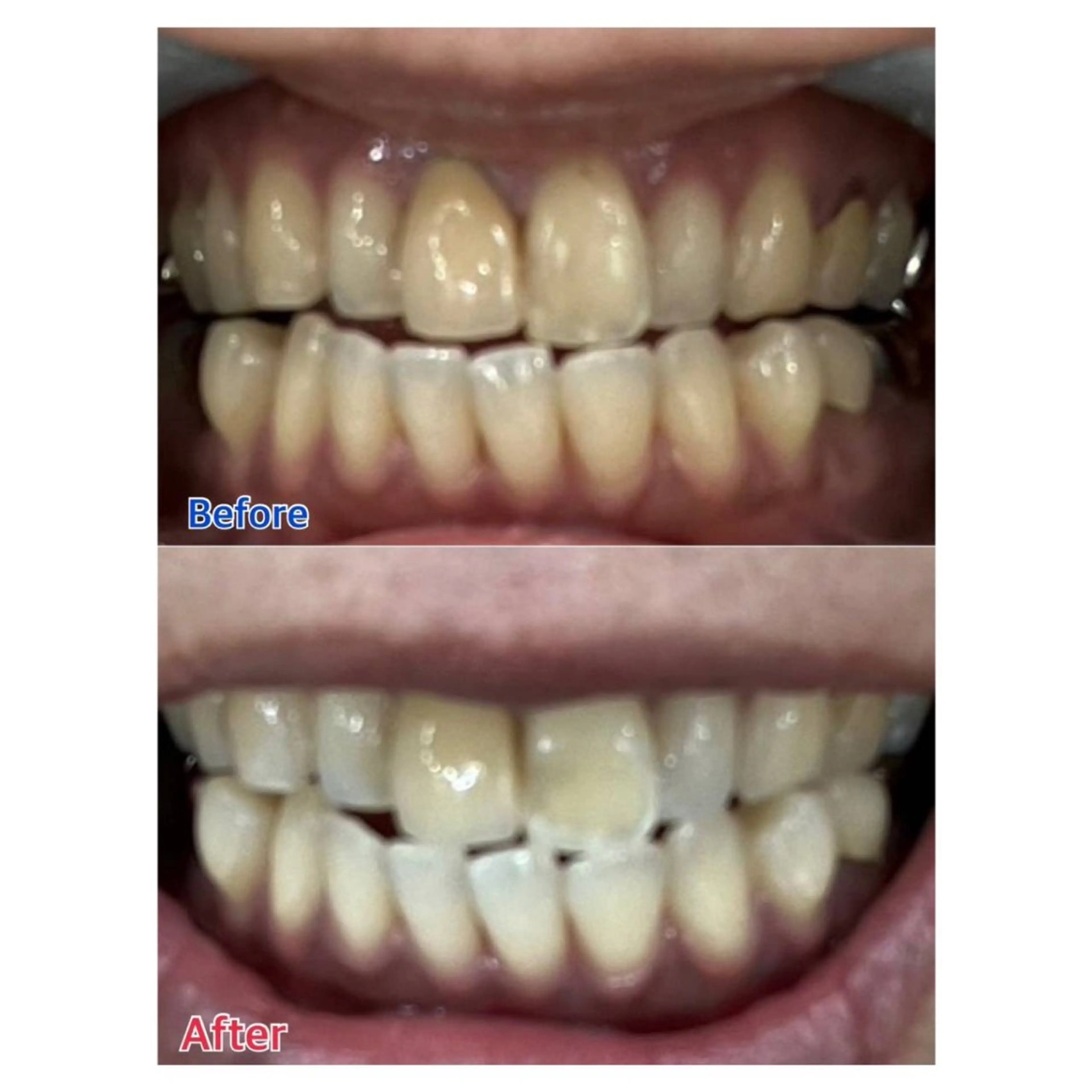 MBEAUTYSALON 千葉店・京成大久保所属・Melty 輝のその他イメージ