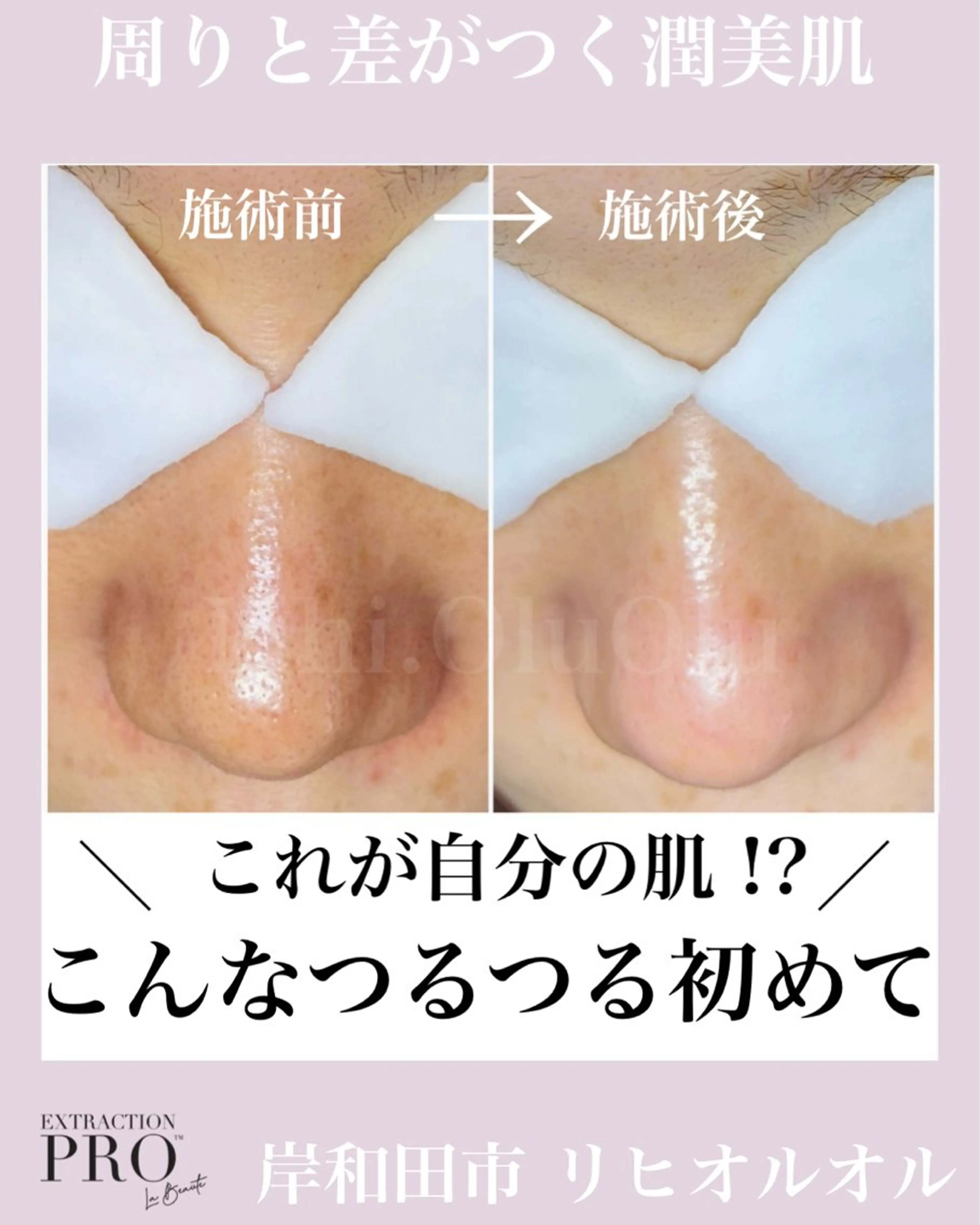 エステ 毛穴汚れ改善専門店/ 岸和田/リヒオルオルのエステ・リラクイメージ