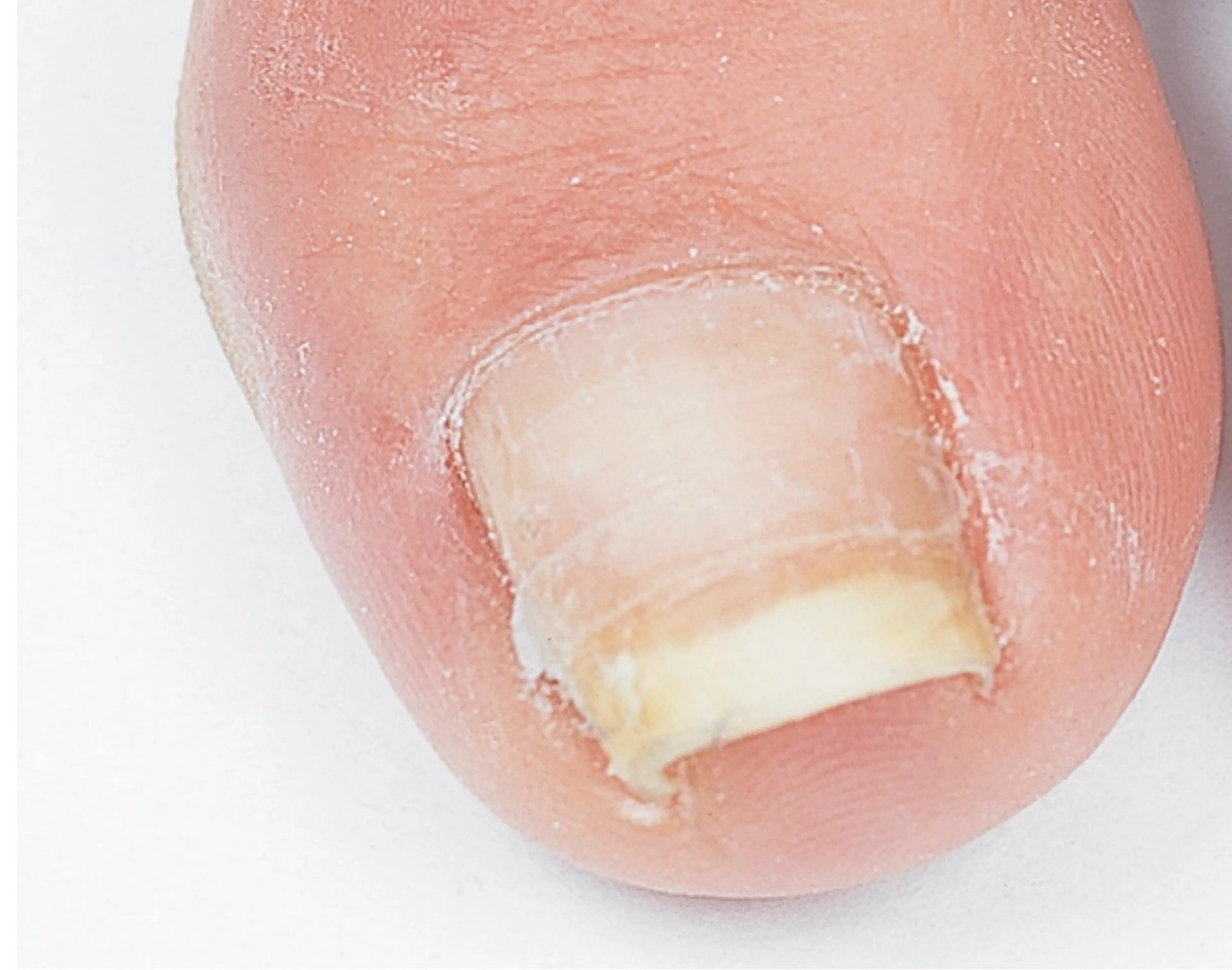 ネイル CHILO 小川のネイルデザイン