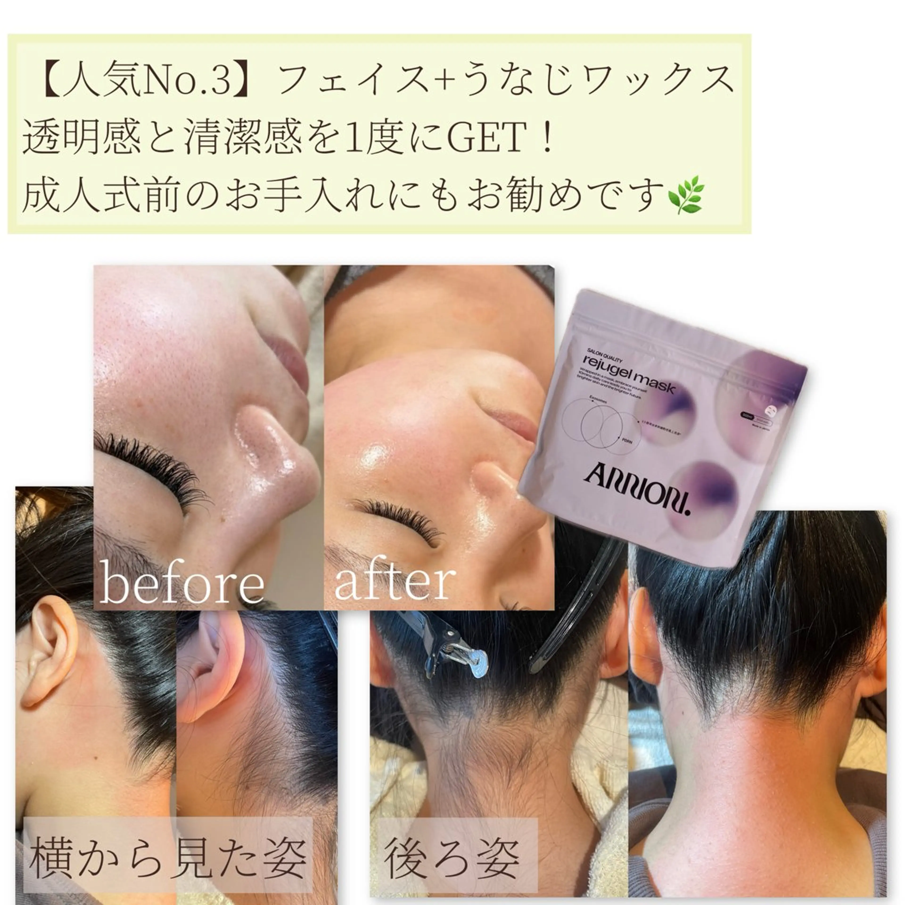 脱毛 Erika komorebi_のエステ・リラクイメージ