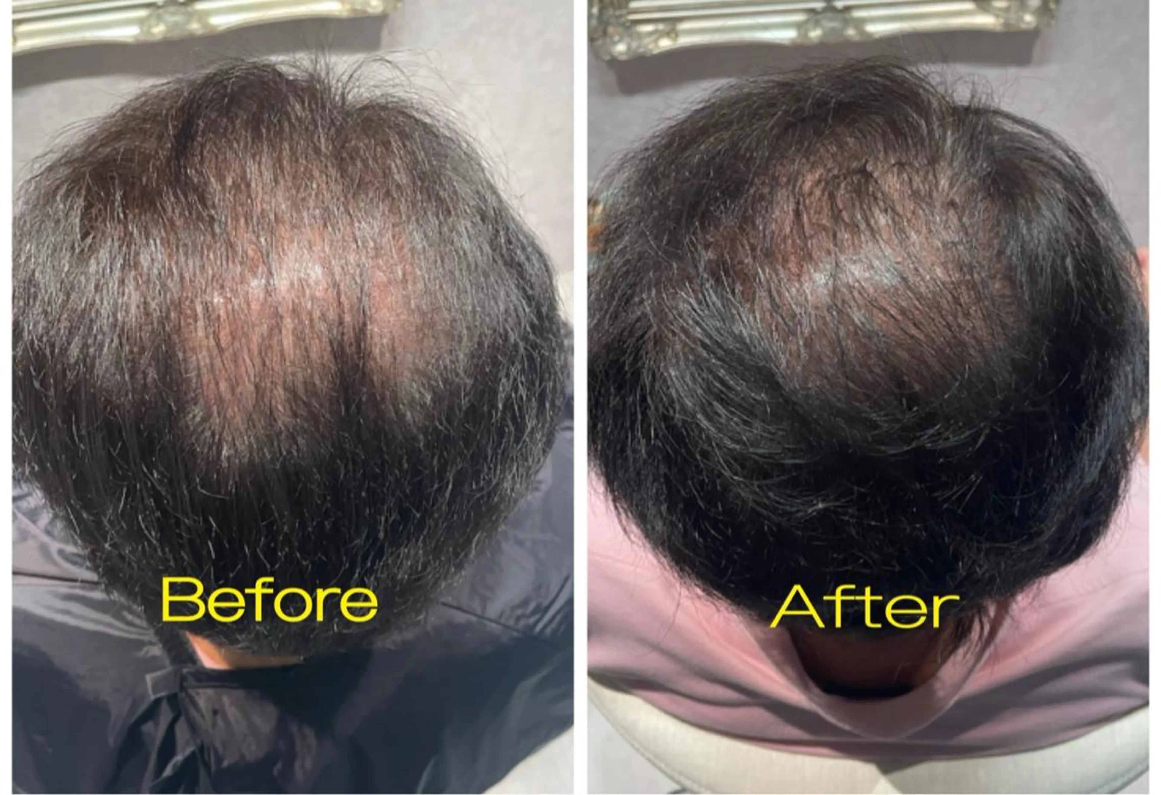 ヘアアレンジ メンズ Kanal Kanaのエステ・リラクイメージ