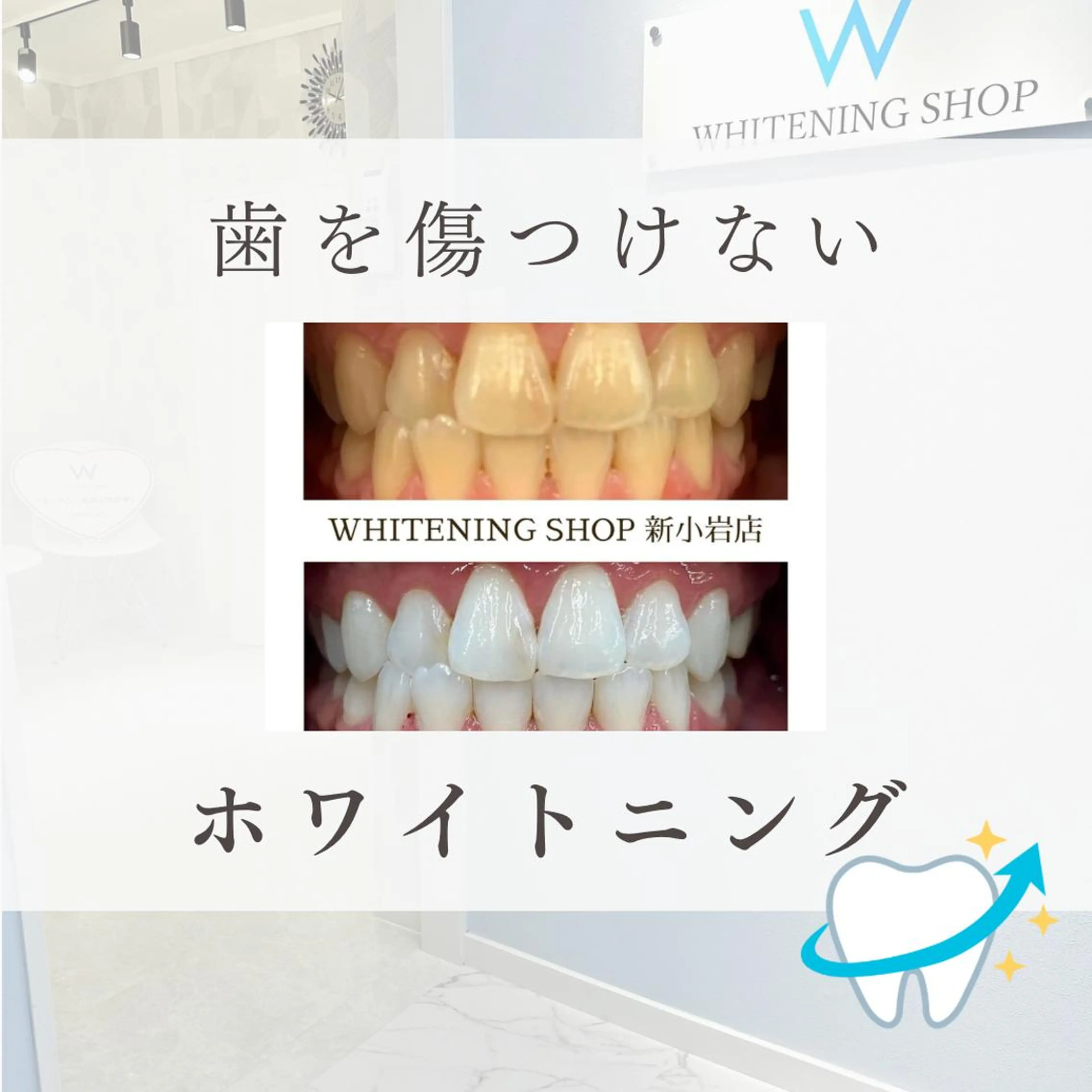 メンズ その他 ホワイトニング ショップ新小岩店のその他イメージ