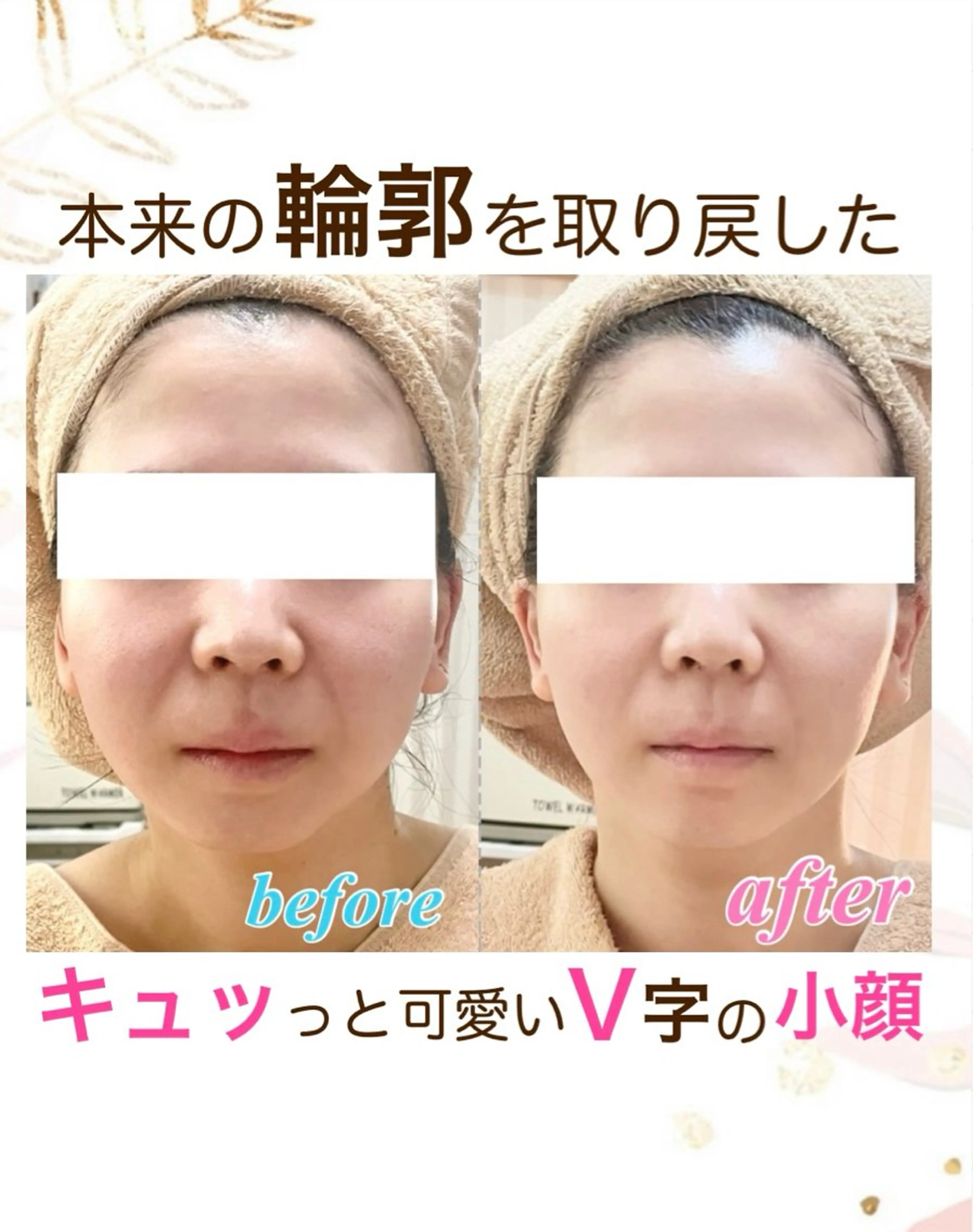 エステ オーダーメイドエステ　ソワンドビジュー所属・美肌×小顔専門/ 亀澤いずみのエステ・リラクイメージ