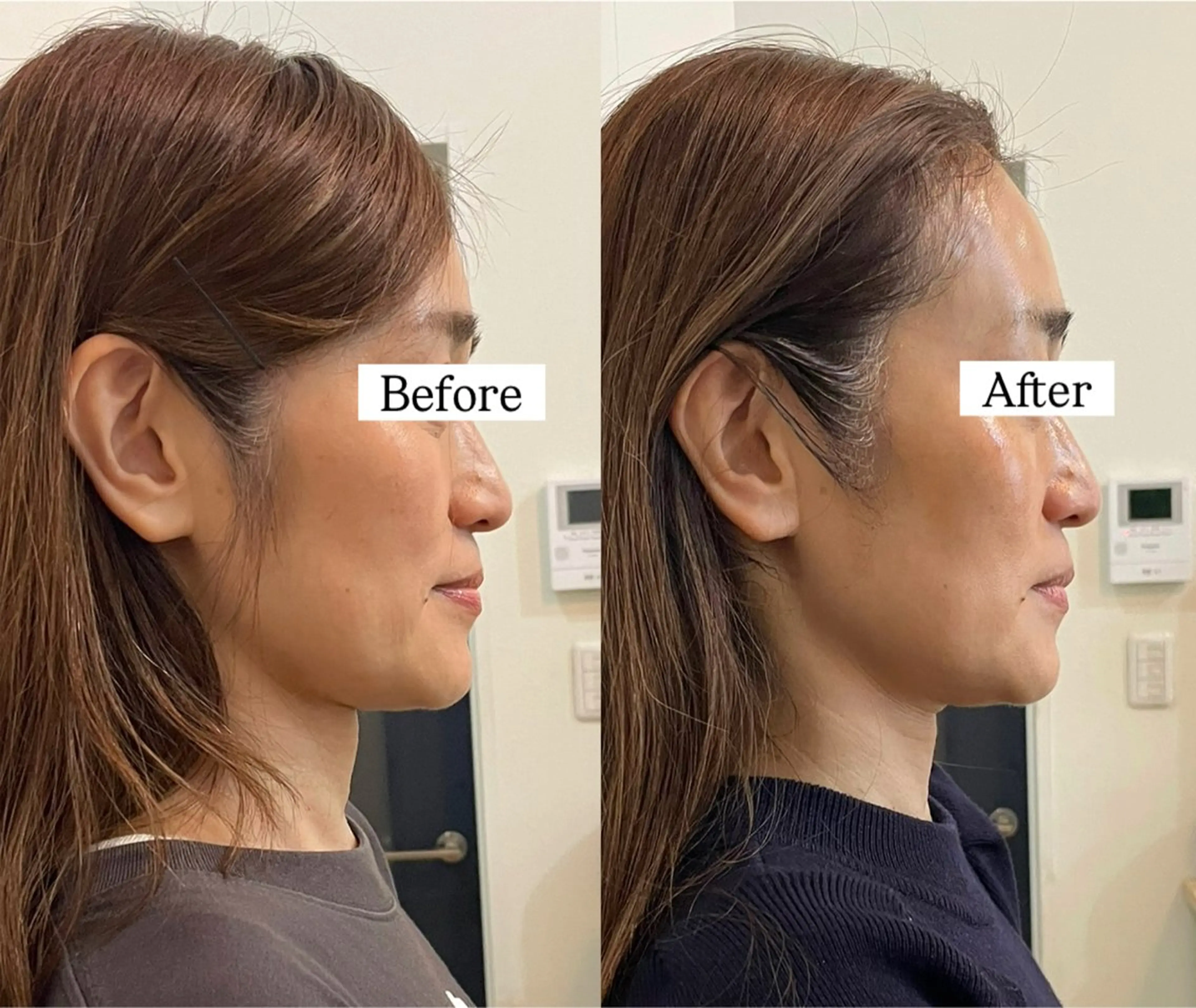 エステ リラク Private SalonOboraのエステ・リラクイメージ