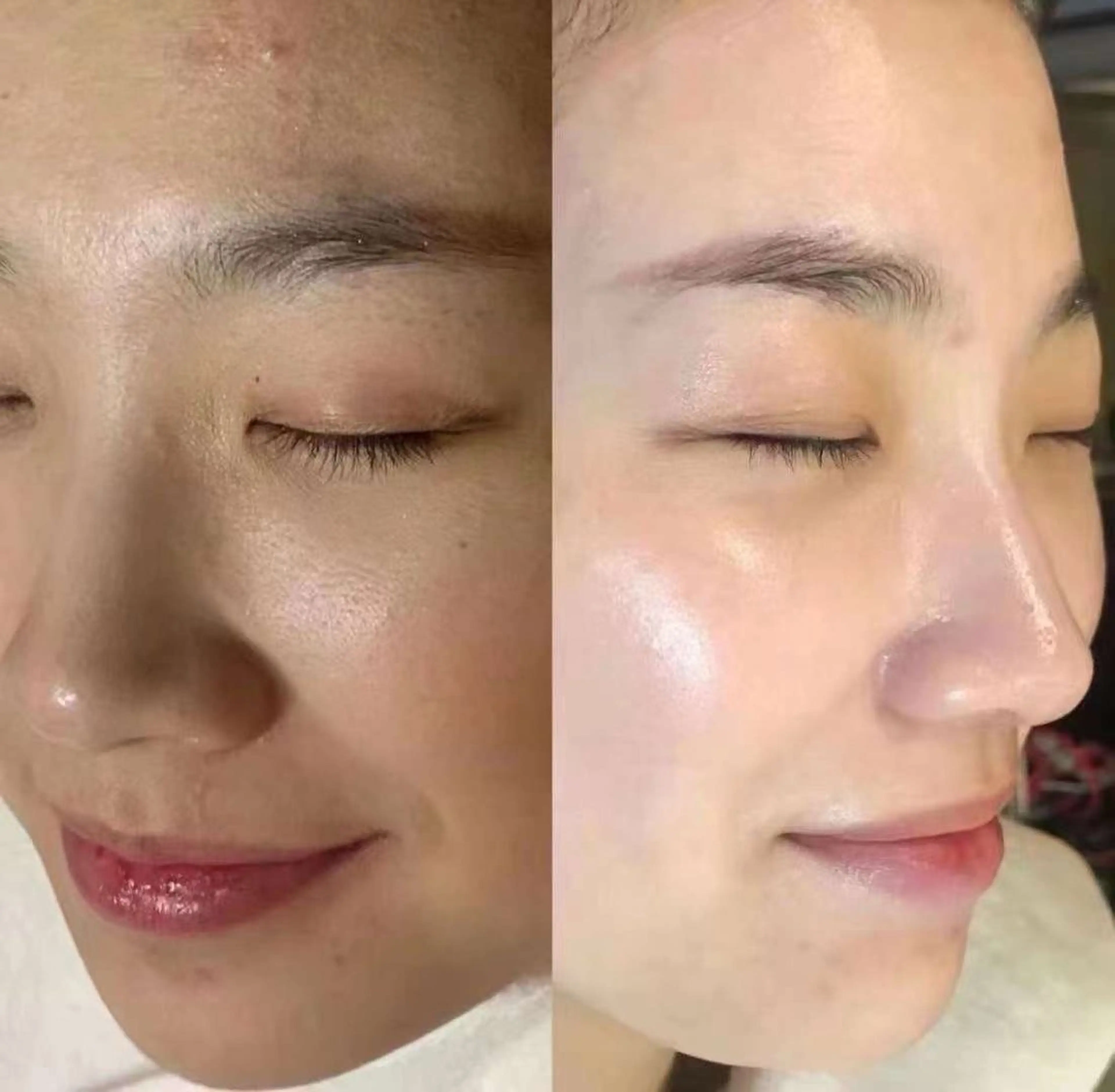 ネイル 韓国ネイル エステ aliaハイフ&水光ジェットサロン所属・aliaハーブ水光店 エステティシャン募集のエステ・リラクイメージ