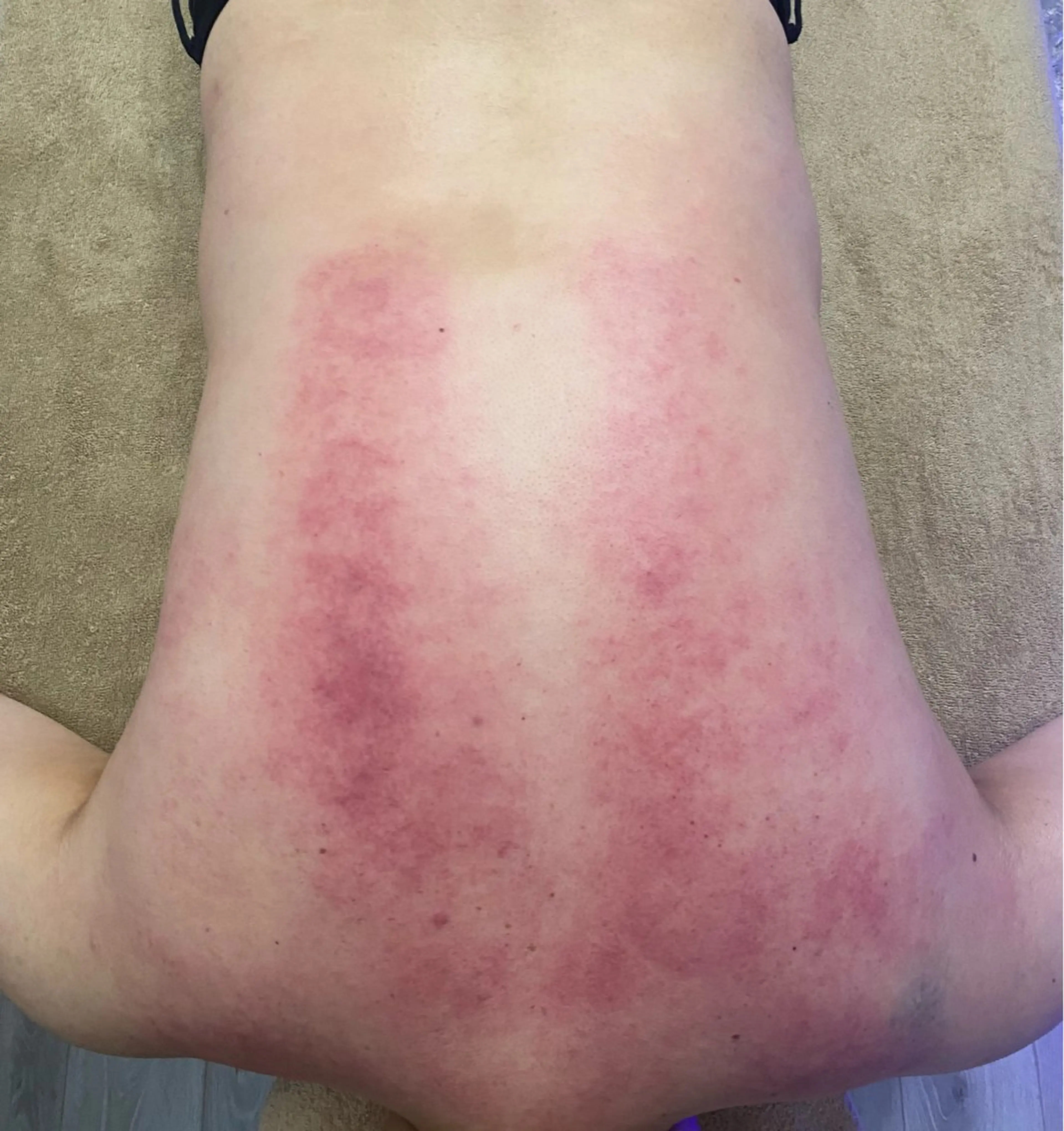 エステ リラク GRACEZ ｸﾞﾚｰｼｽﾞのエステ・リラクイメージ