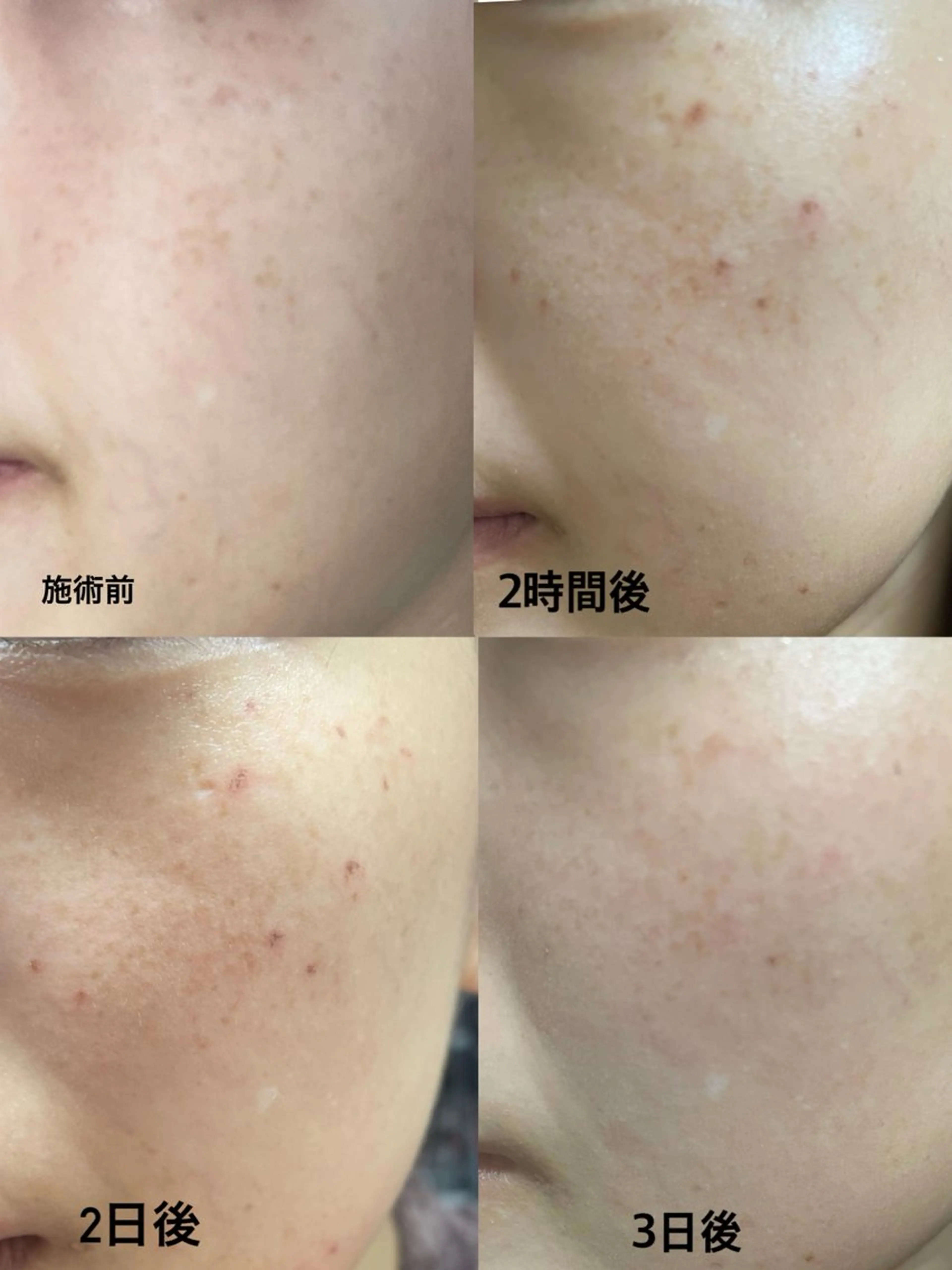 エステ private salon VIALL所属・プライベートサロン VIALLのエステ・リラクイメージ