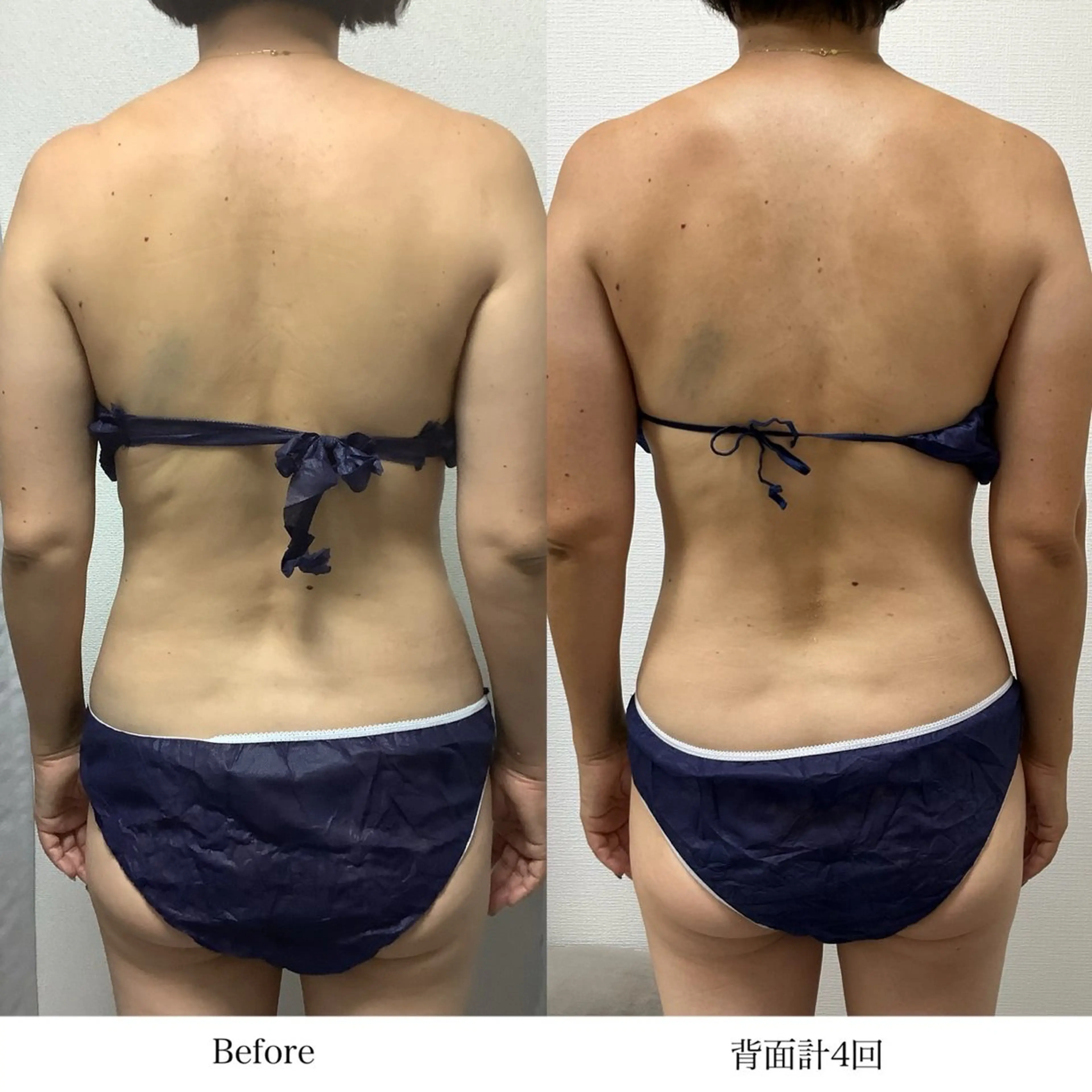 冷却専門店 SLARIのエステ・リラクイメージ