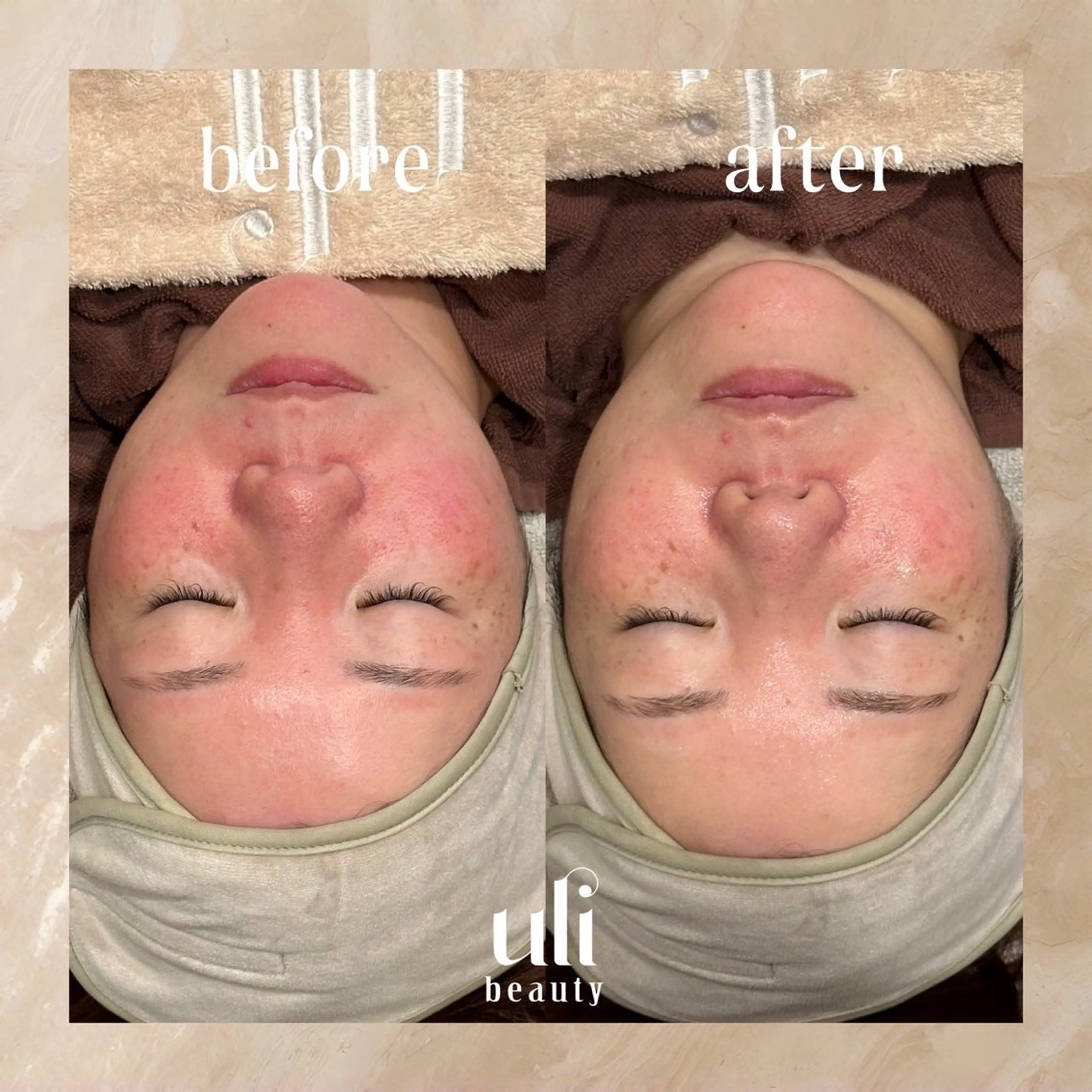エステ uli beauty所属・韓国肌管理サロン ulibeautyのエステ・リラクイメージ