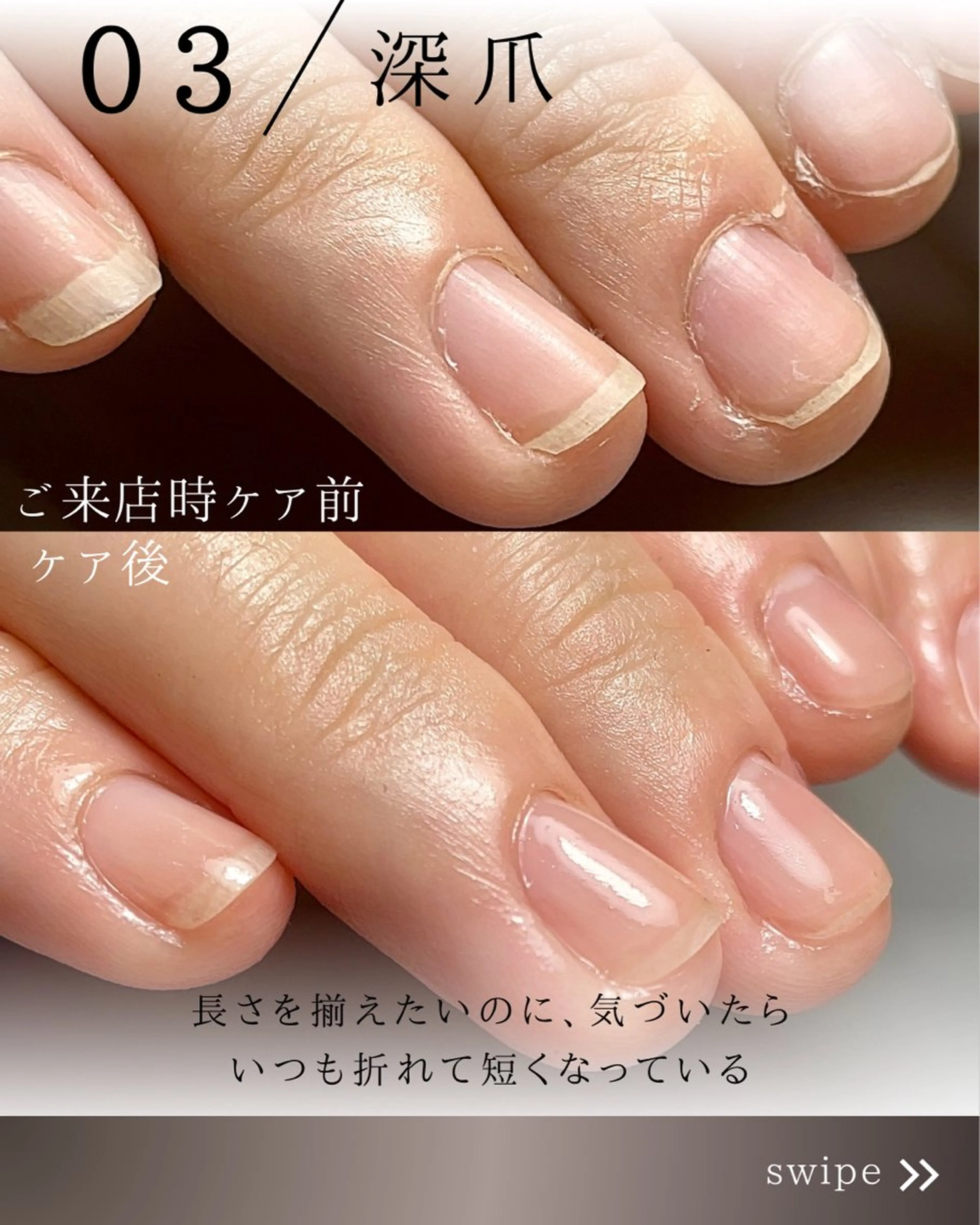 ネイル ジェルネイル Aim* 深爪・爪育ケア専門店のネイルデザイン