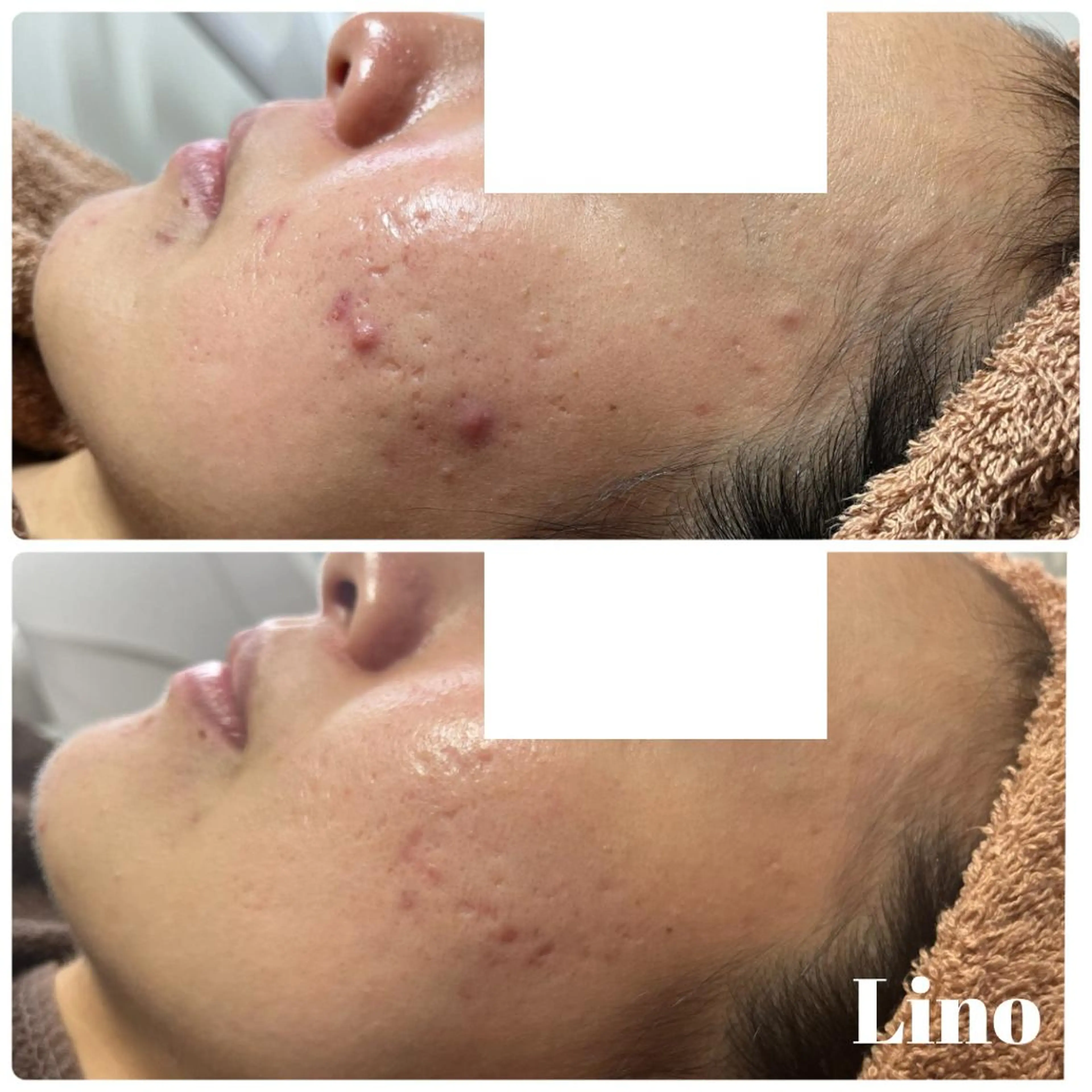 beautysalon  LINO所属・7月限定【平日限定】 全メニュ¥4,400のエステ・リラクイメージ