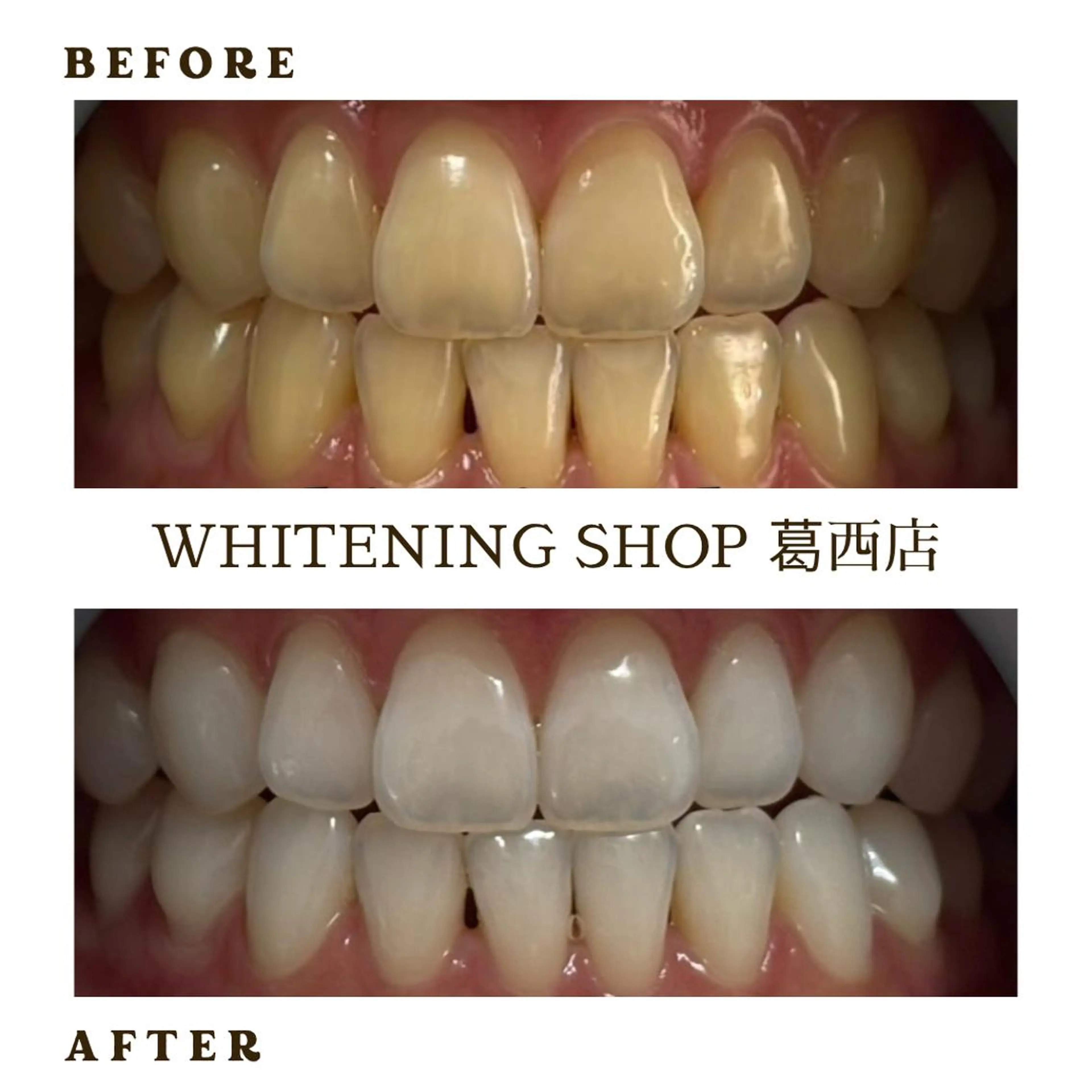 メンズ その他 ホワイトニング ショップ葛西店のその他イメージ