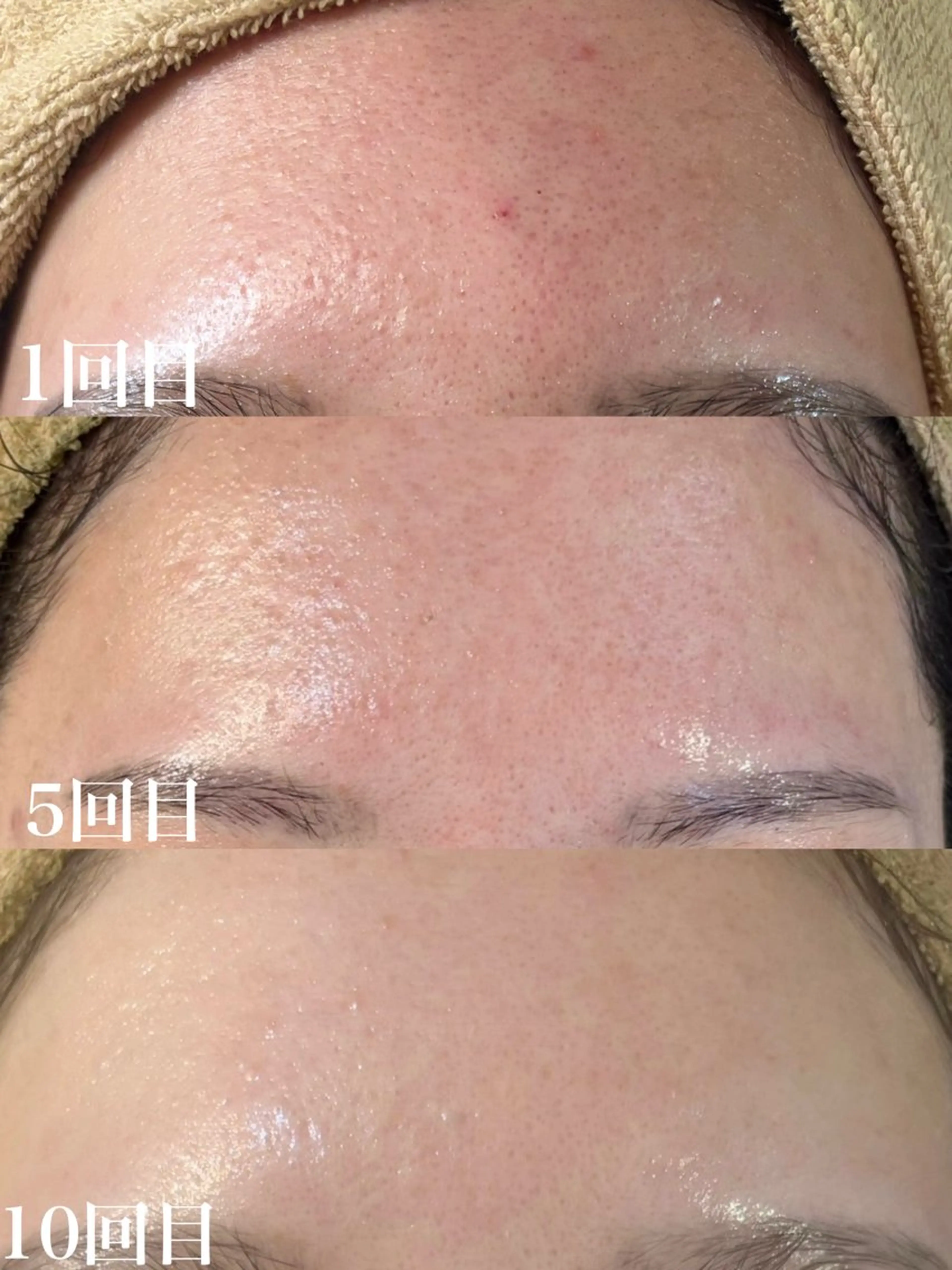 エステ WHITE AQUA 北千住店のエステ・リラクイメージ