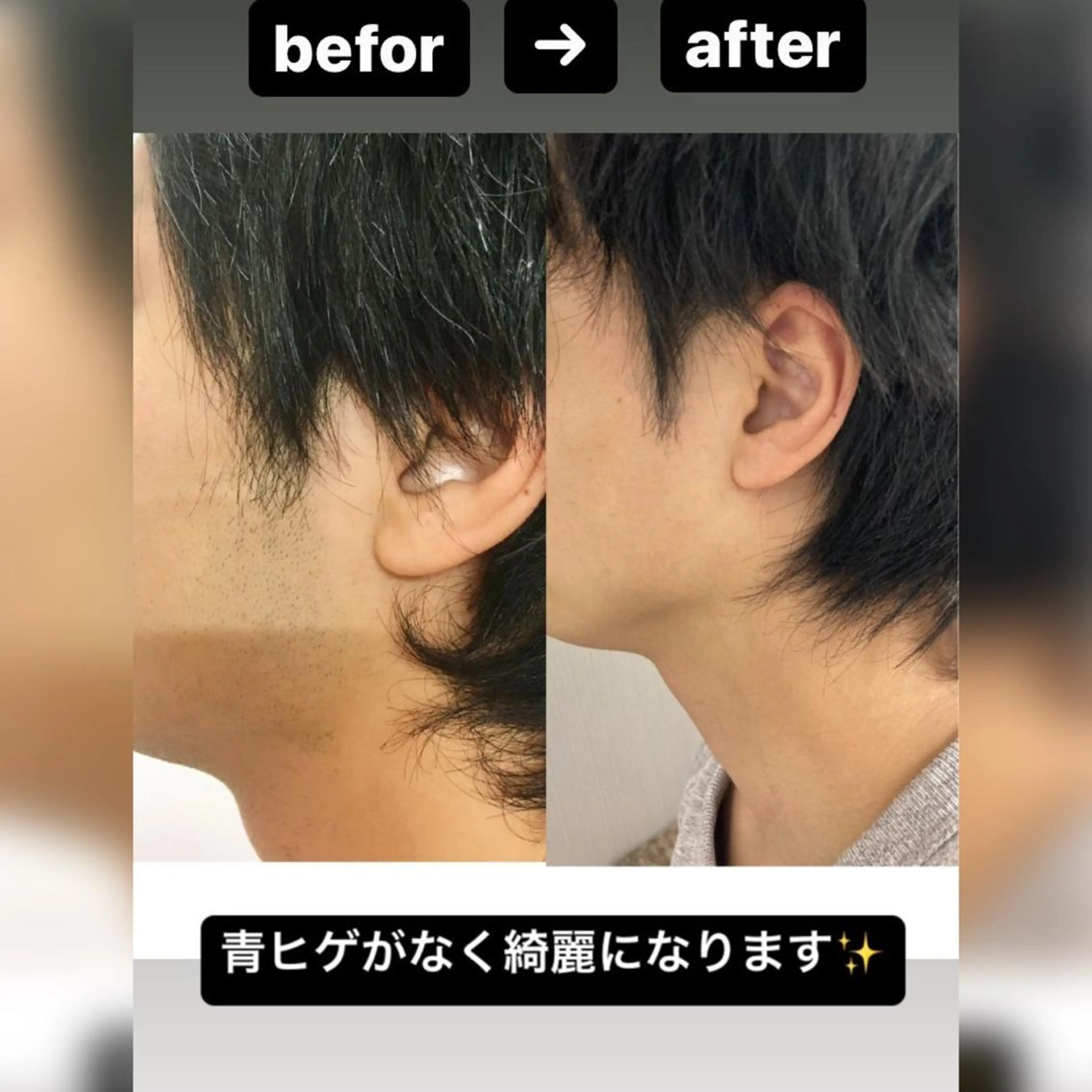 メンズ 脱毛 Beauty K's【ビューティーケイズ】所属・メンズ脱毛サロン ／金山昌弘のエステ・リラクイメージ