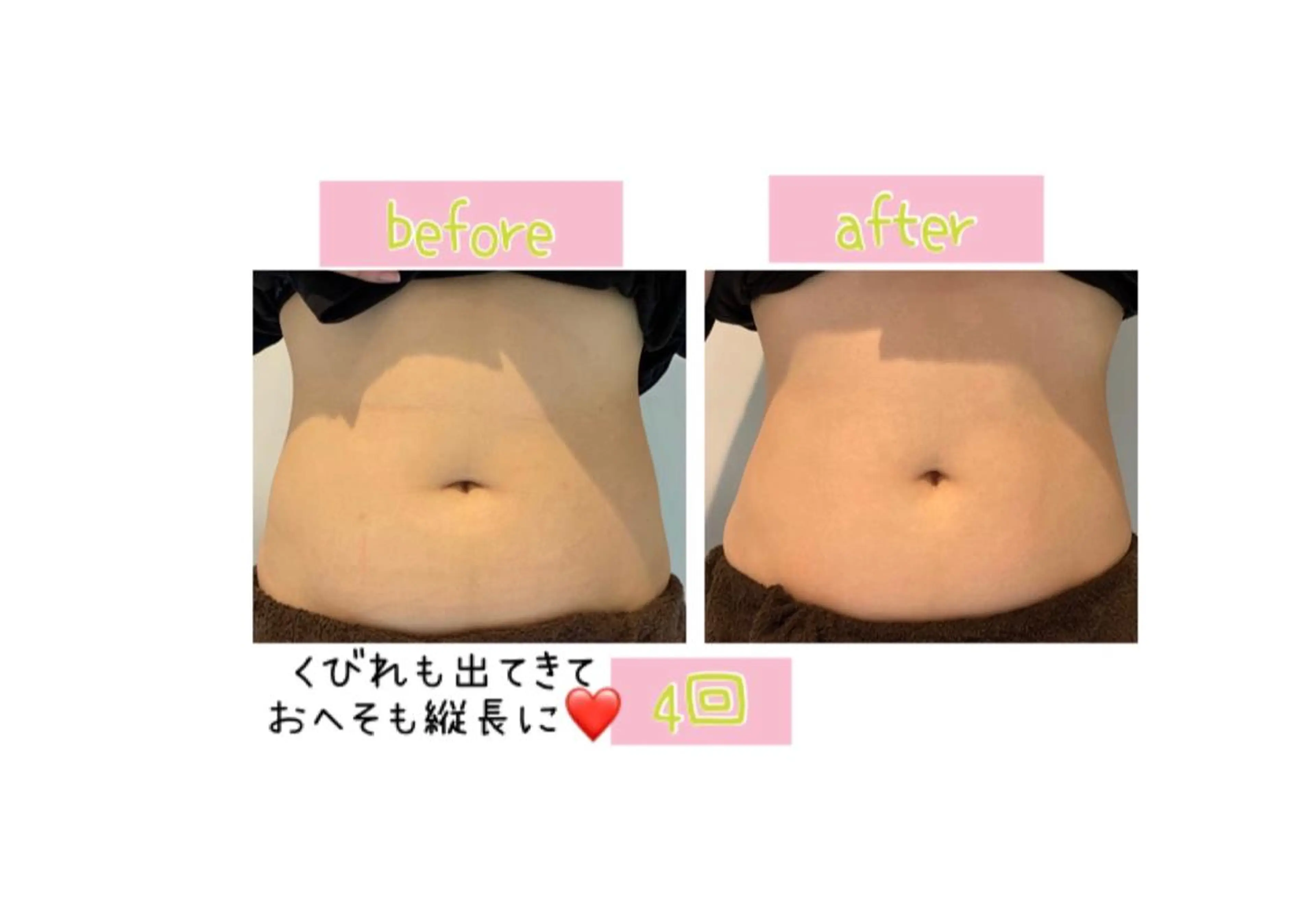 メンズ エステ リラク 癒し腸もみサロン シャユーム　ゆきなのその他イメージ