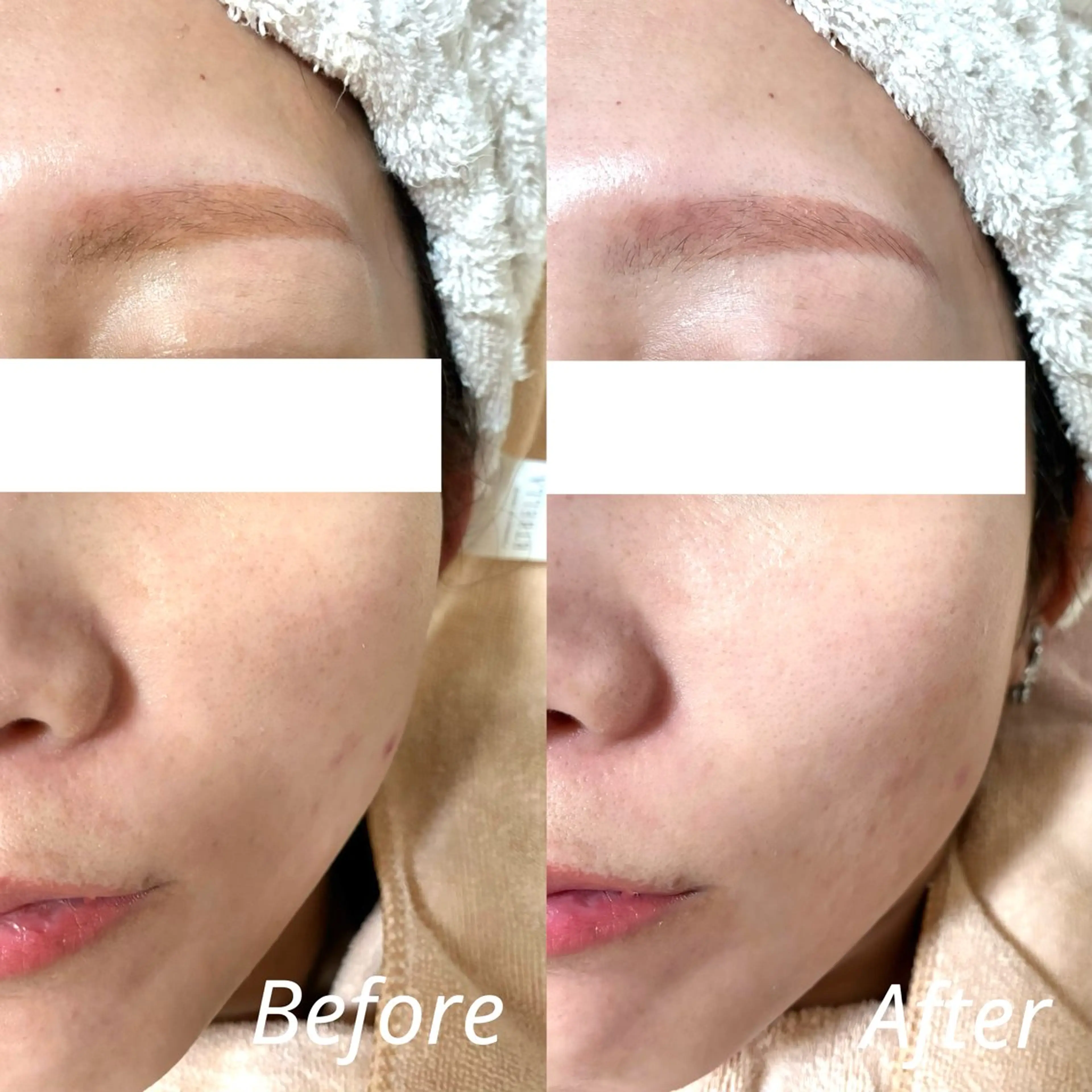 エステ アイラッシュサロン リリィ🪷下山のエステ・リラクイメージ