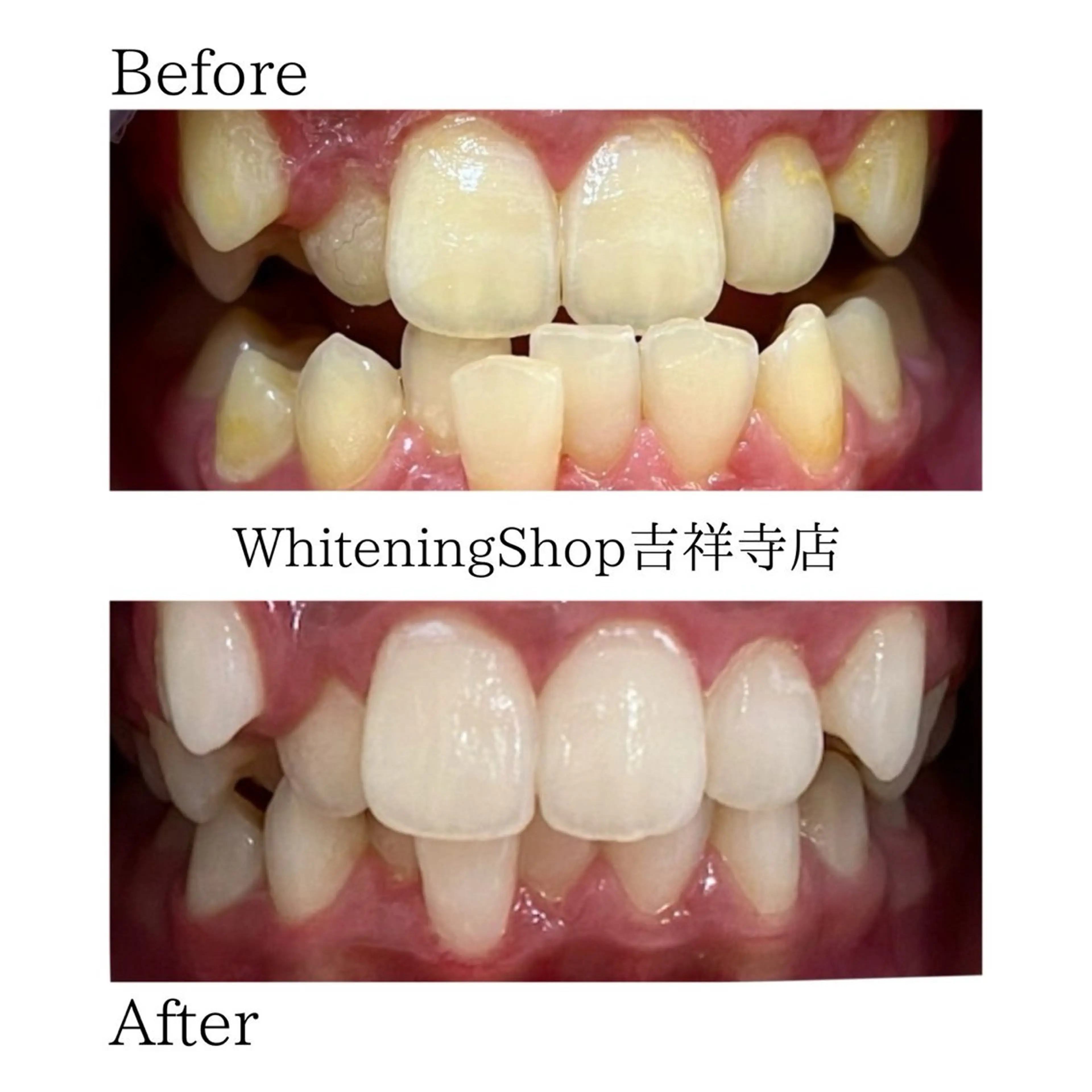 エステ リラク ホワイトニング ショップ吉祥寺店のエステ・リラクイメージ