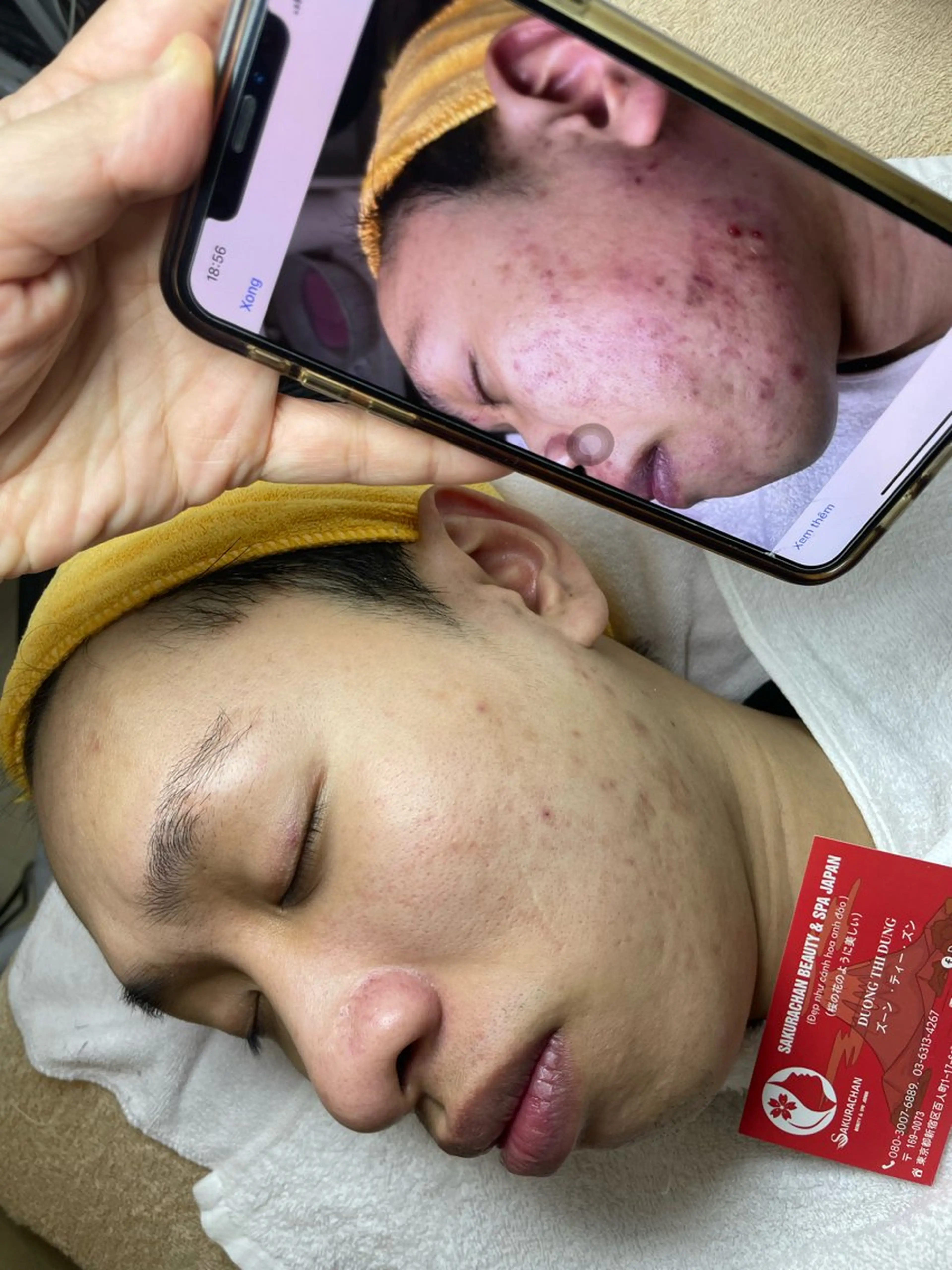 ニキビ、痩身、脱毛、 サクラチャンスパのエステ・リラクイメージ