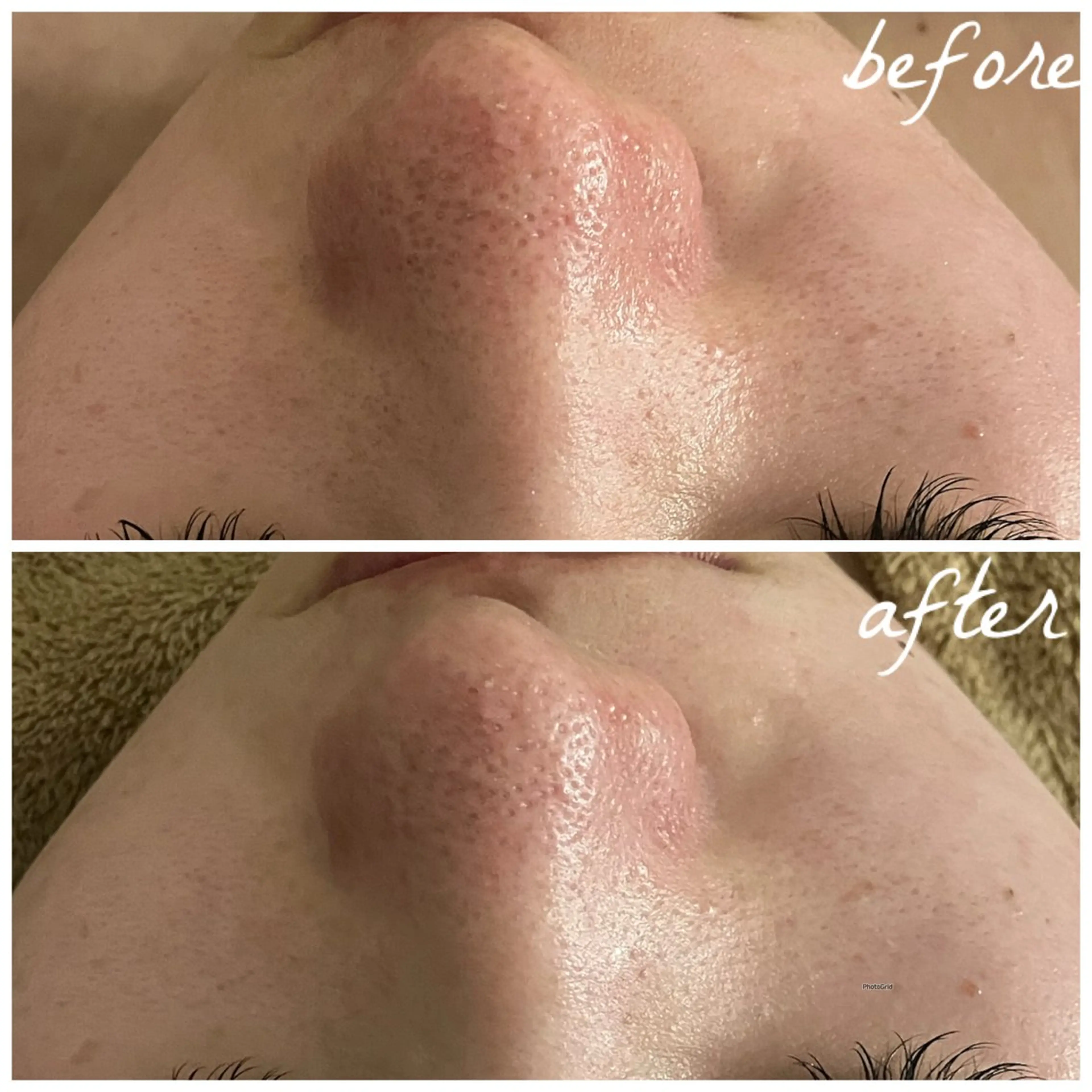 メンズ エステ メナード岐阜茜部 杉浦のエステ・リラクイメージ