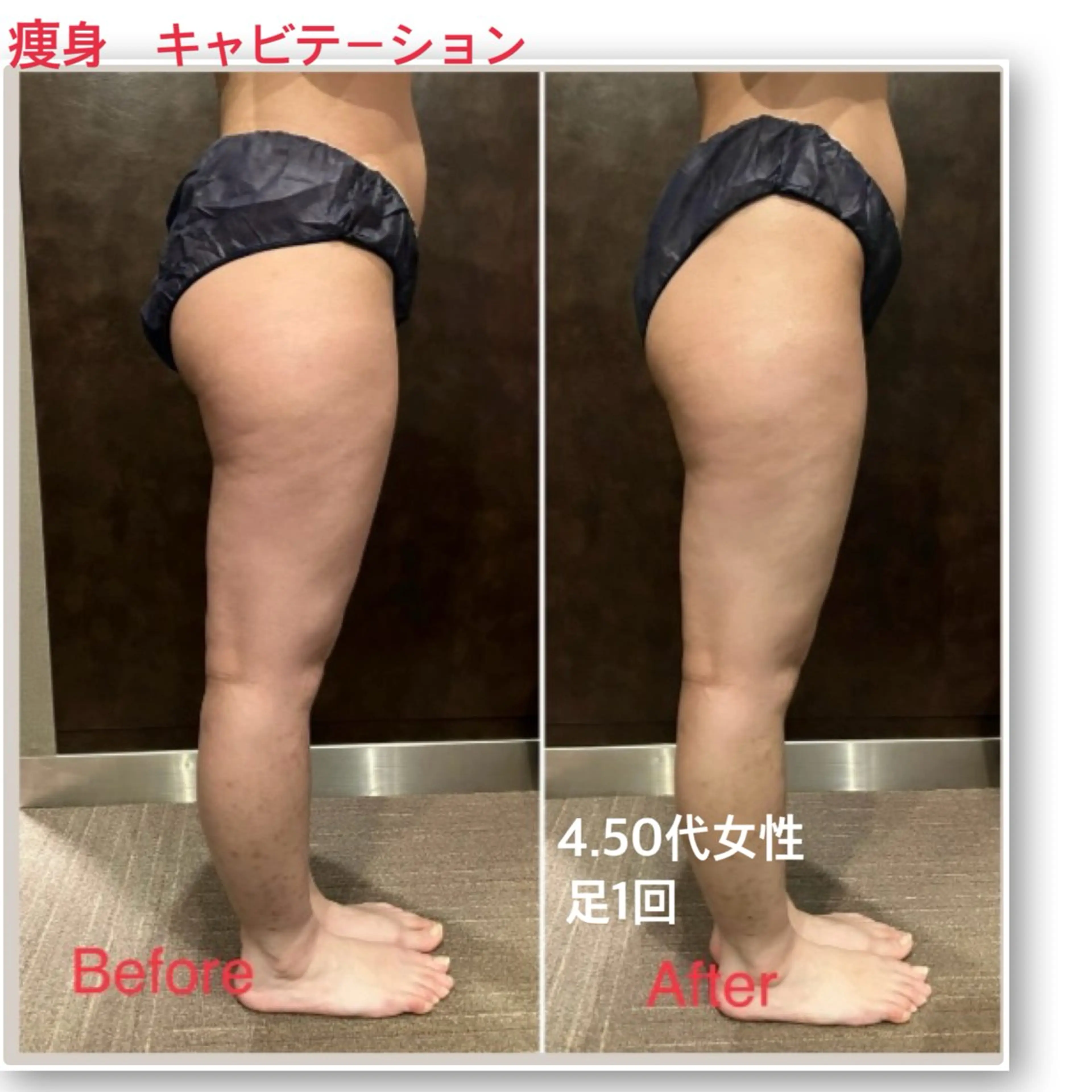 エステ リラク まいまい／八尾／JR 久宝寺／サロンのエステ・リラクイメージ