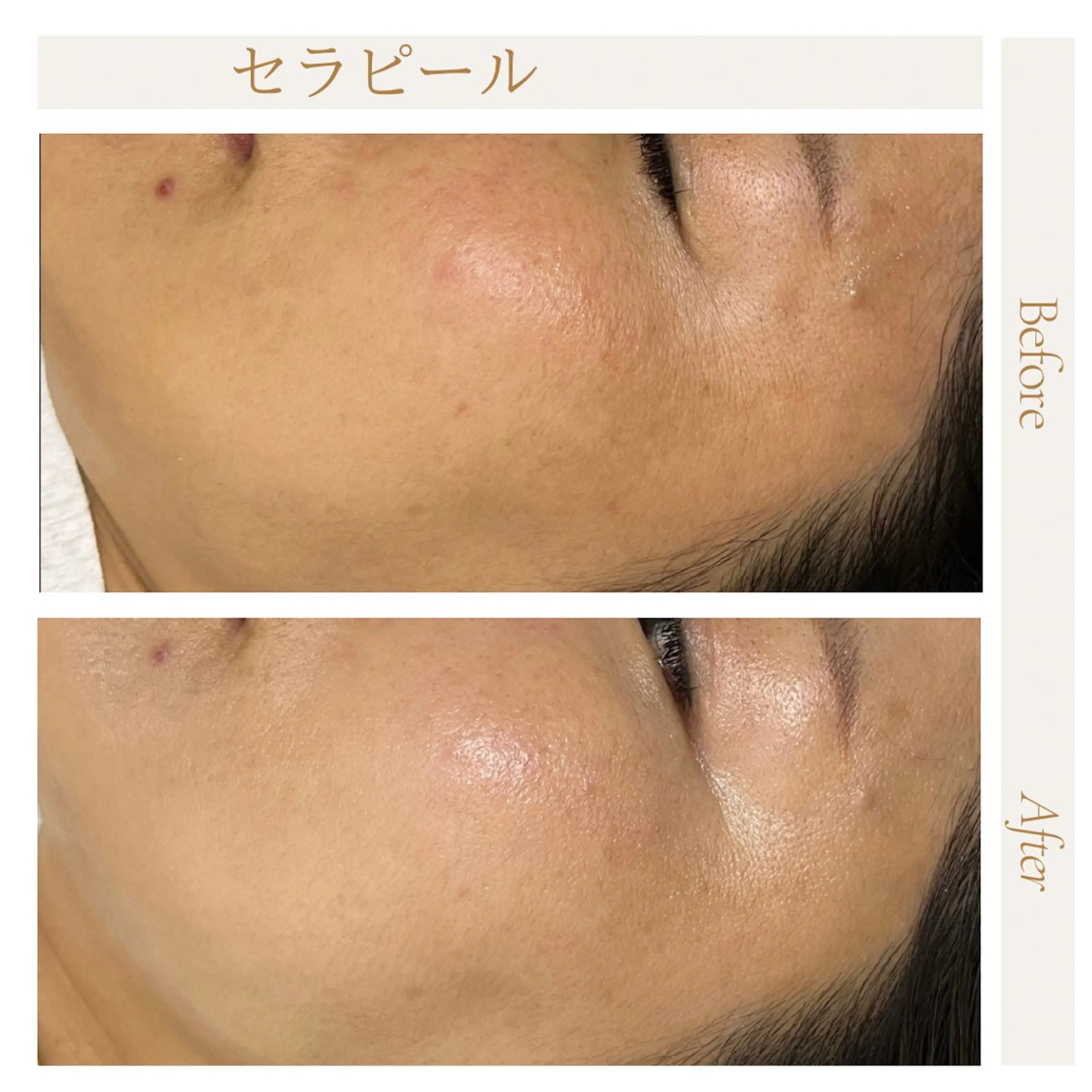 privatesalon icca所属・mana iccaのエステ・リラクイメージ