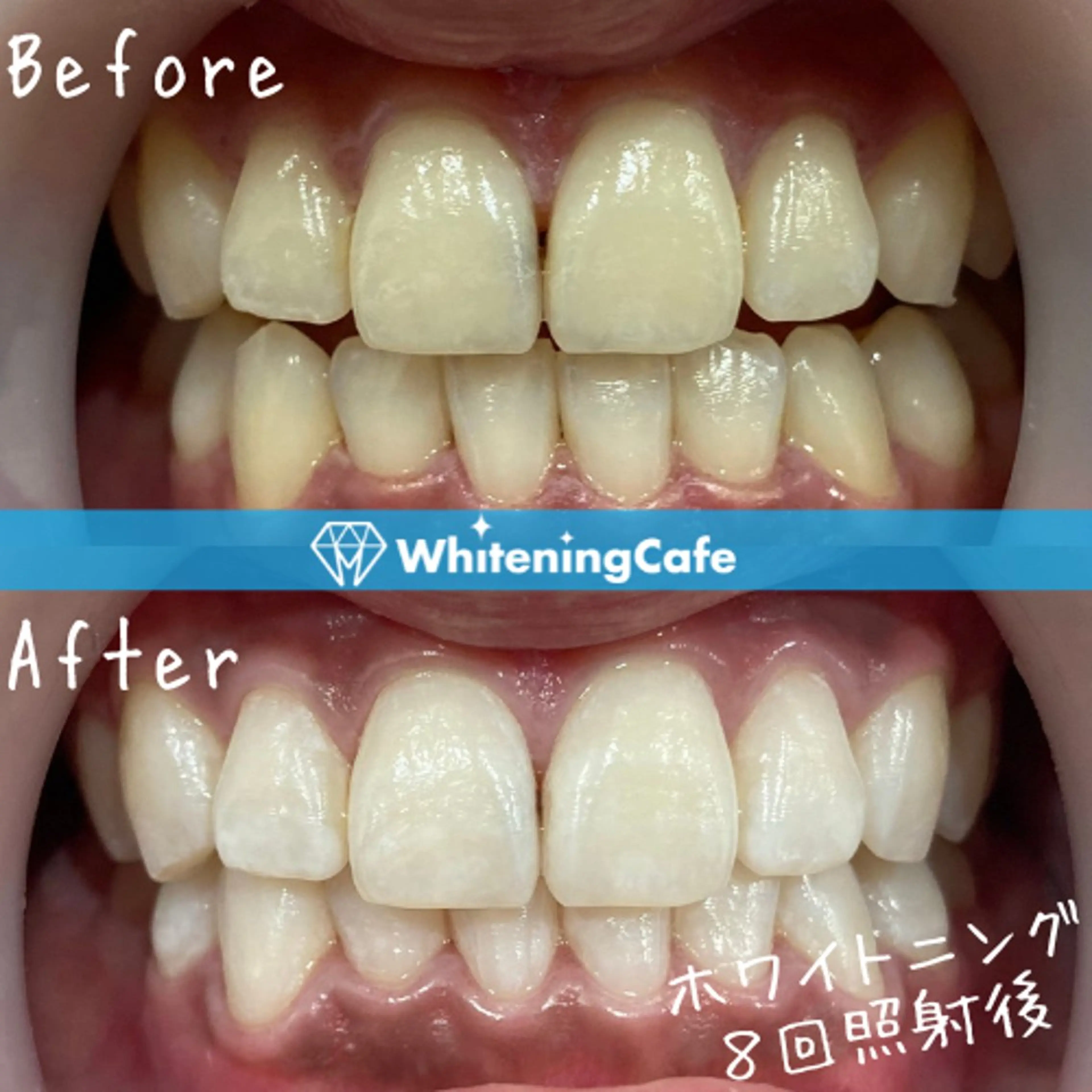 ホワイトニングカフェ神戸元町店所属・ホワイトニングカフェ 神戸元町店のエステ・リラクイメージ