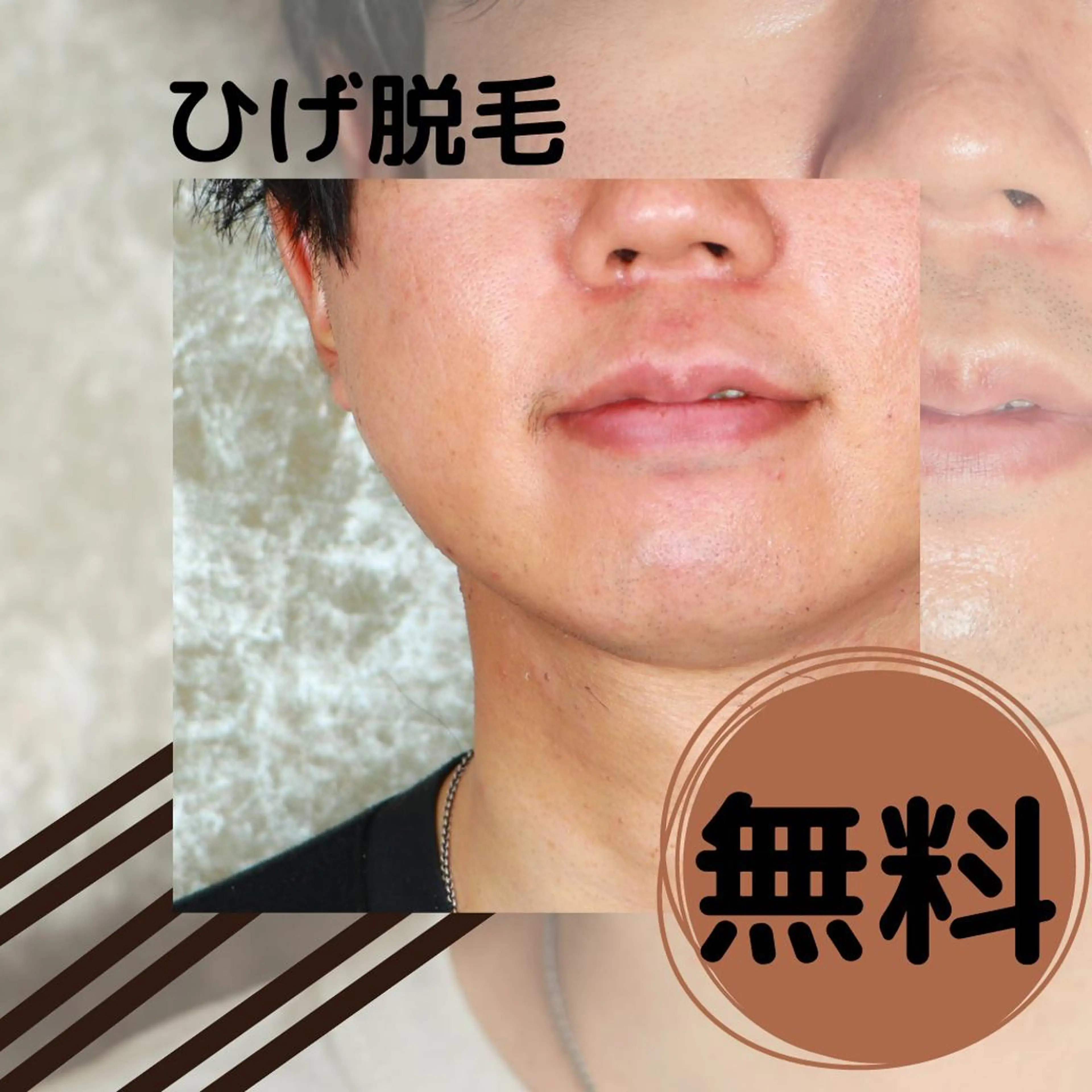 メンズ 20代から始める脱毛 salonLEPIAのエステ・リラクイメージ