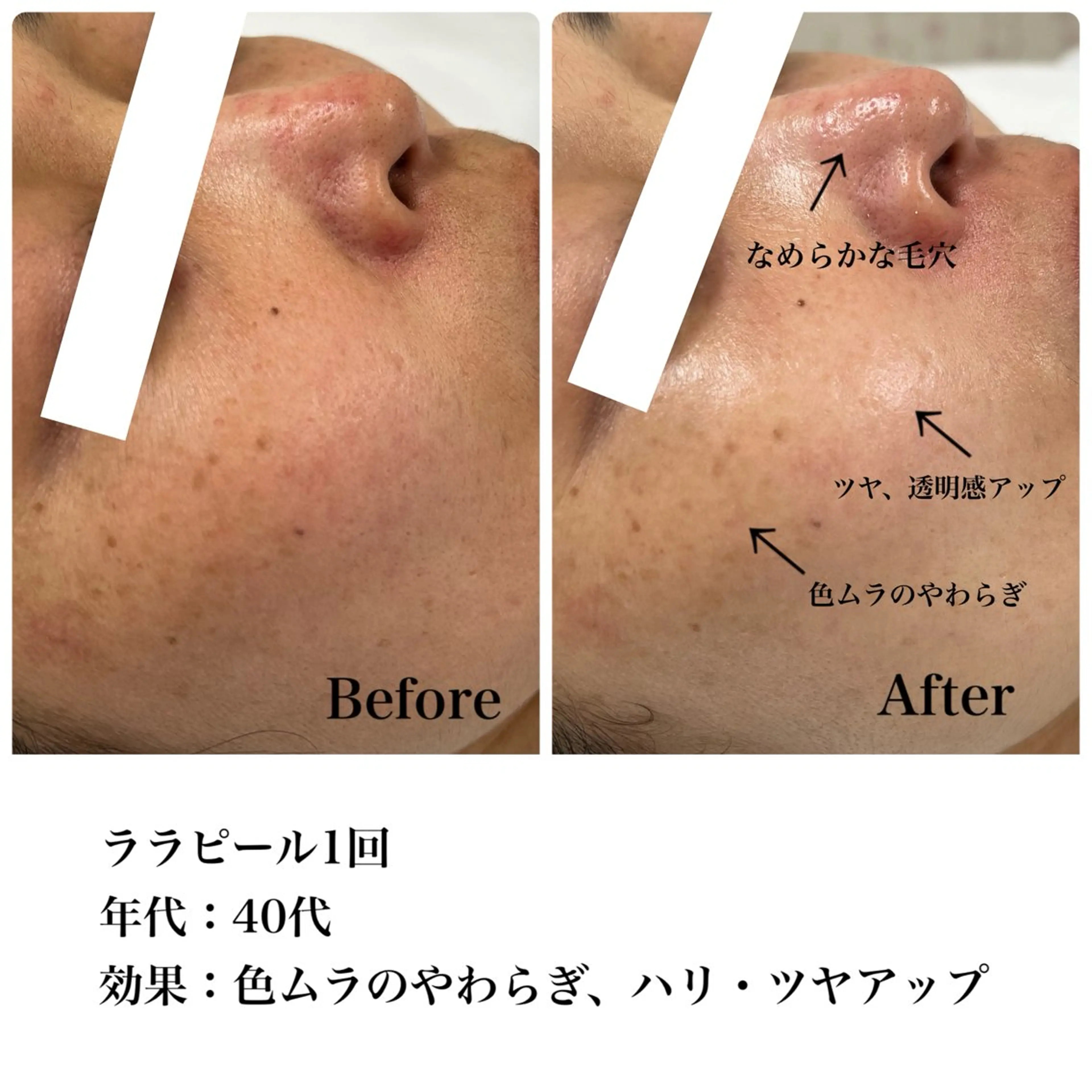 Astorie SHIORIのエステ・リラクイメージ