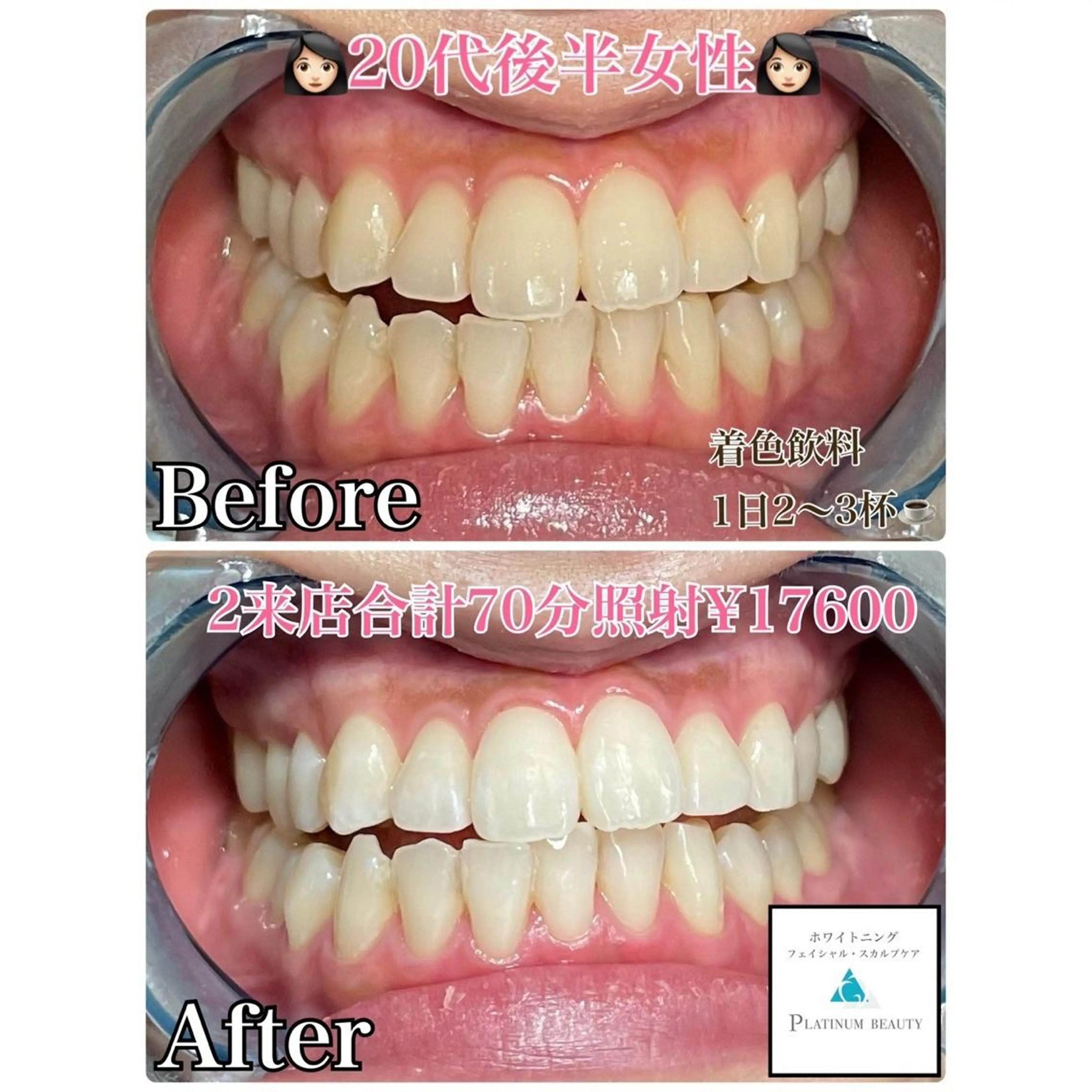 ホワイトニングビューティー西宮店所属・ホワイトニングビュー ティー西宮店のその他イメージ