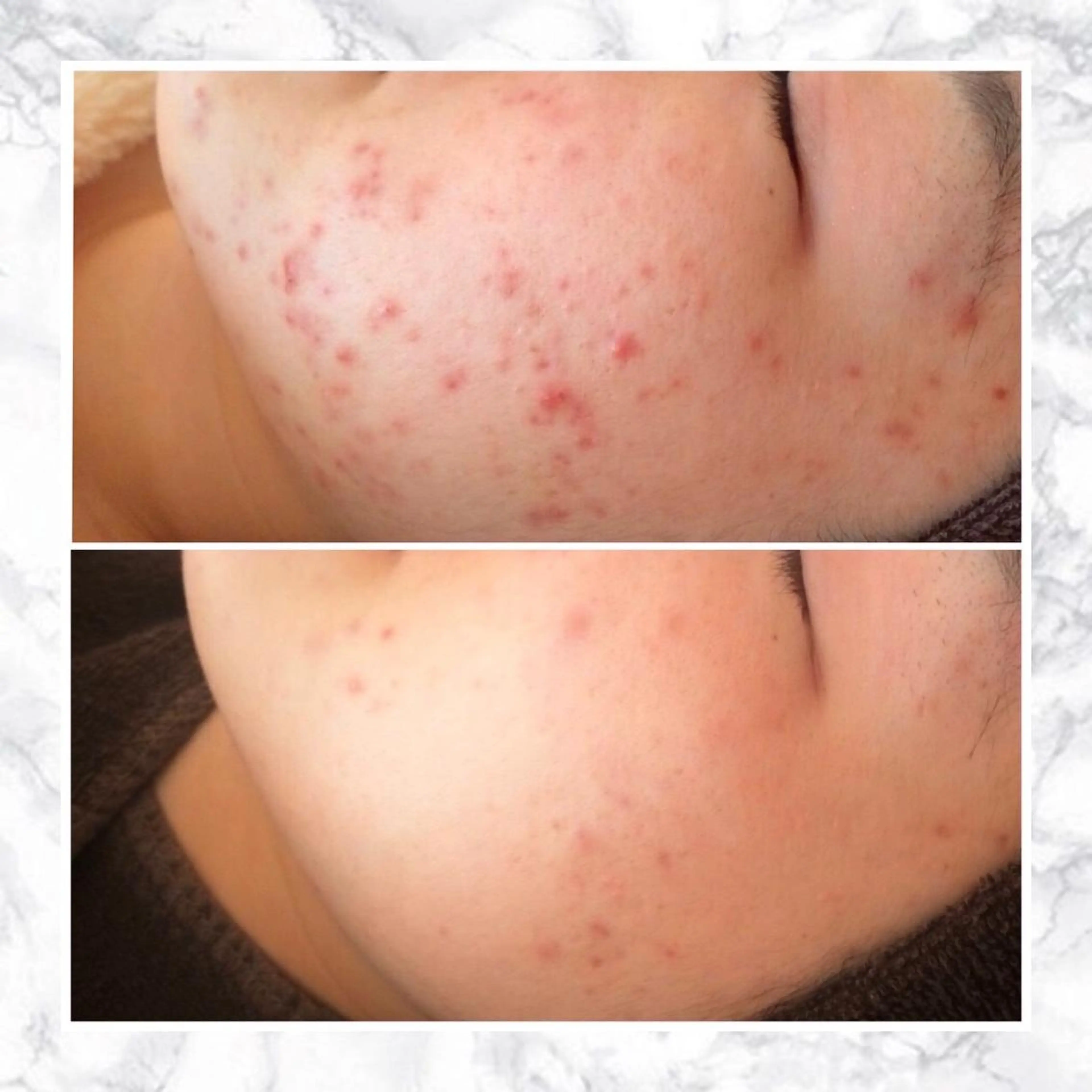 セミロング カラー パーマ ヘアアレンジ メンズ キッズ ネイル マツエク・マツパ アイブロウ 触れたくなる モテ肌へ...❤︎のエステ・リラクイメージ