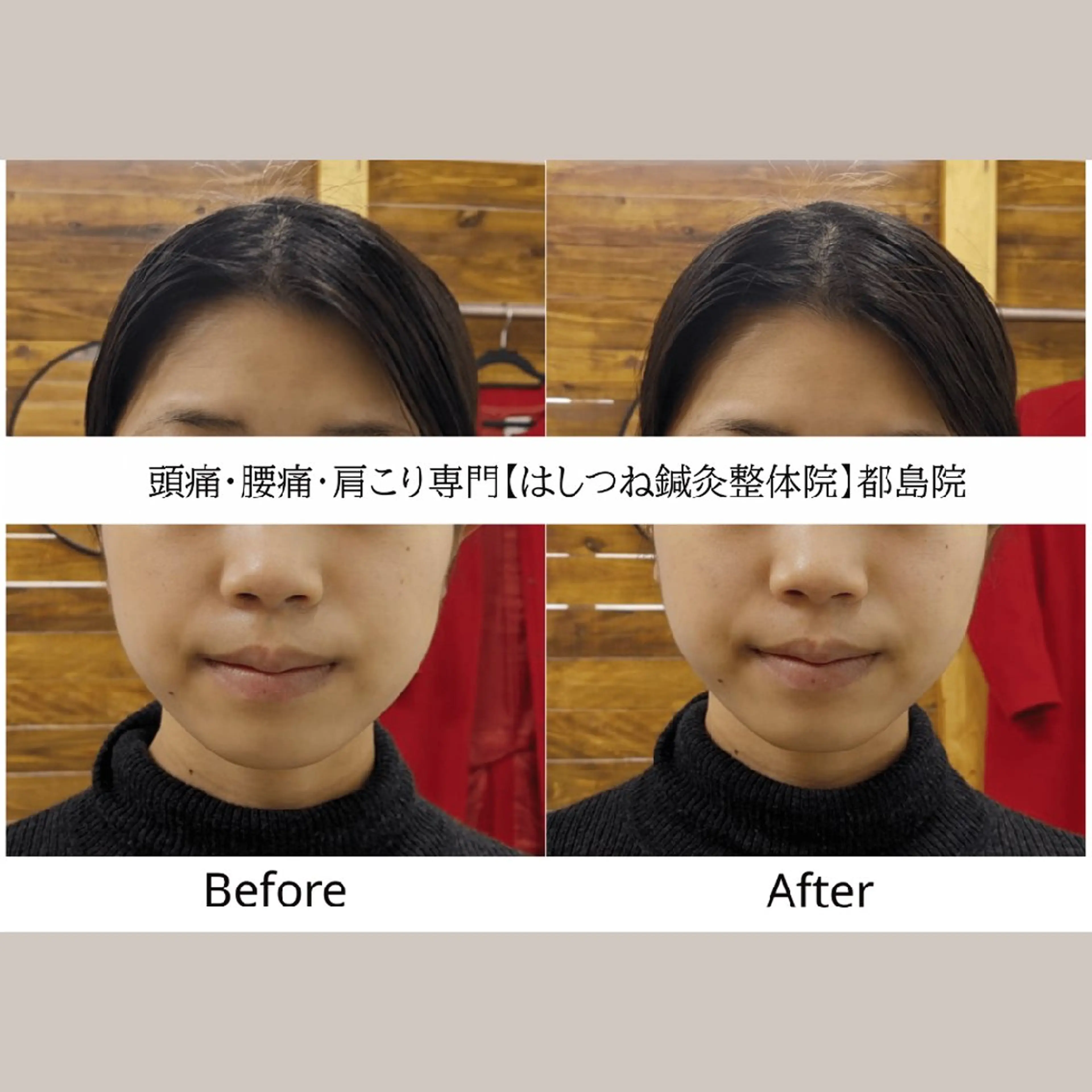 リラク 頭痛・腰痛・美容鍼に 特化してます。　橋岡のエステ・リラクイメージ