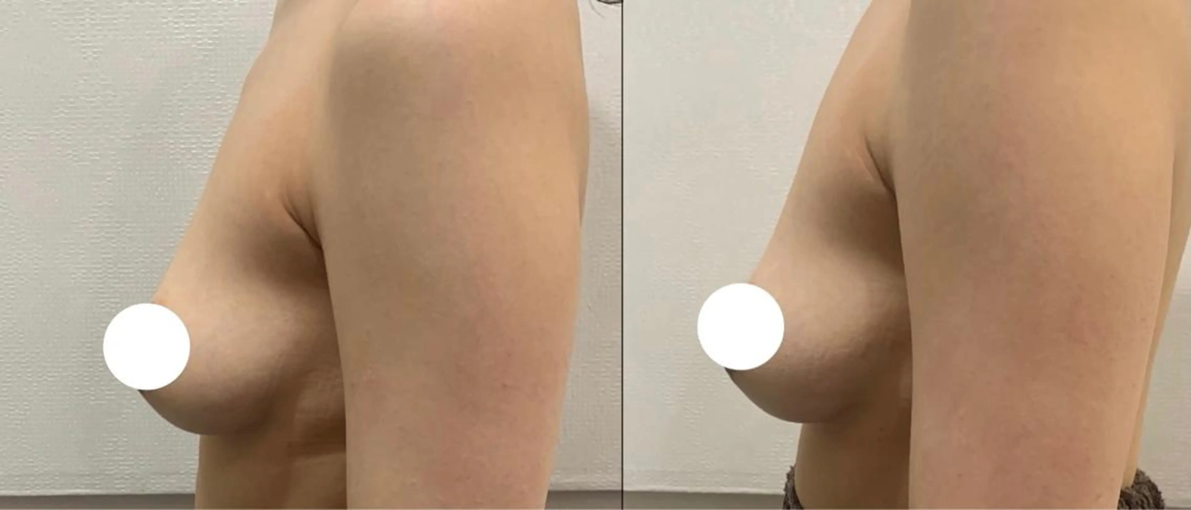 毛穴改善/脱毛 ネイル　川上久仁子のエステ・リラクイメージ