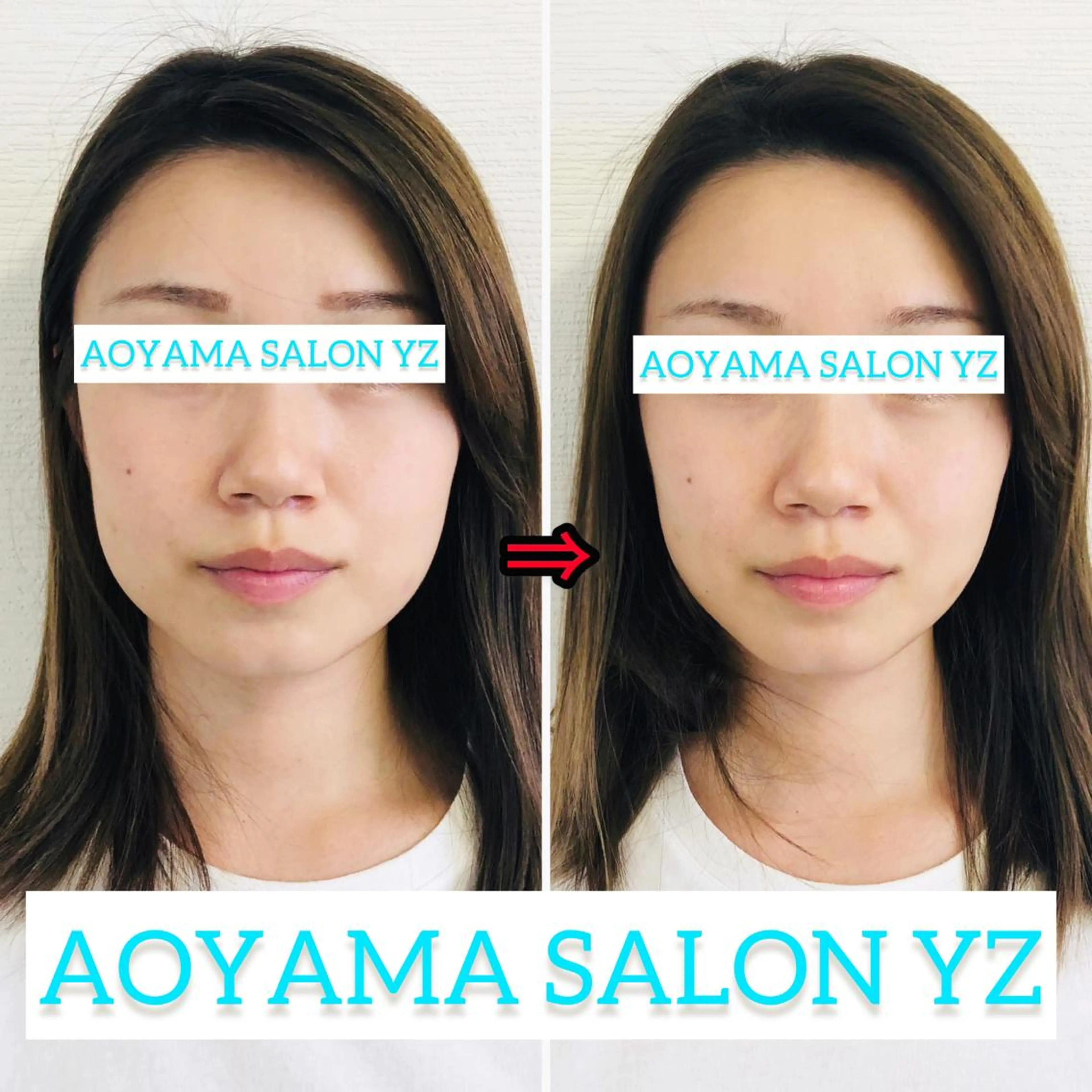 エステ リラク 小顔美容鍼専門サロン 渋谷YZのエステ・リラクイメージ