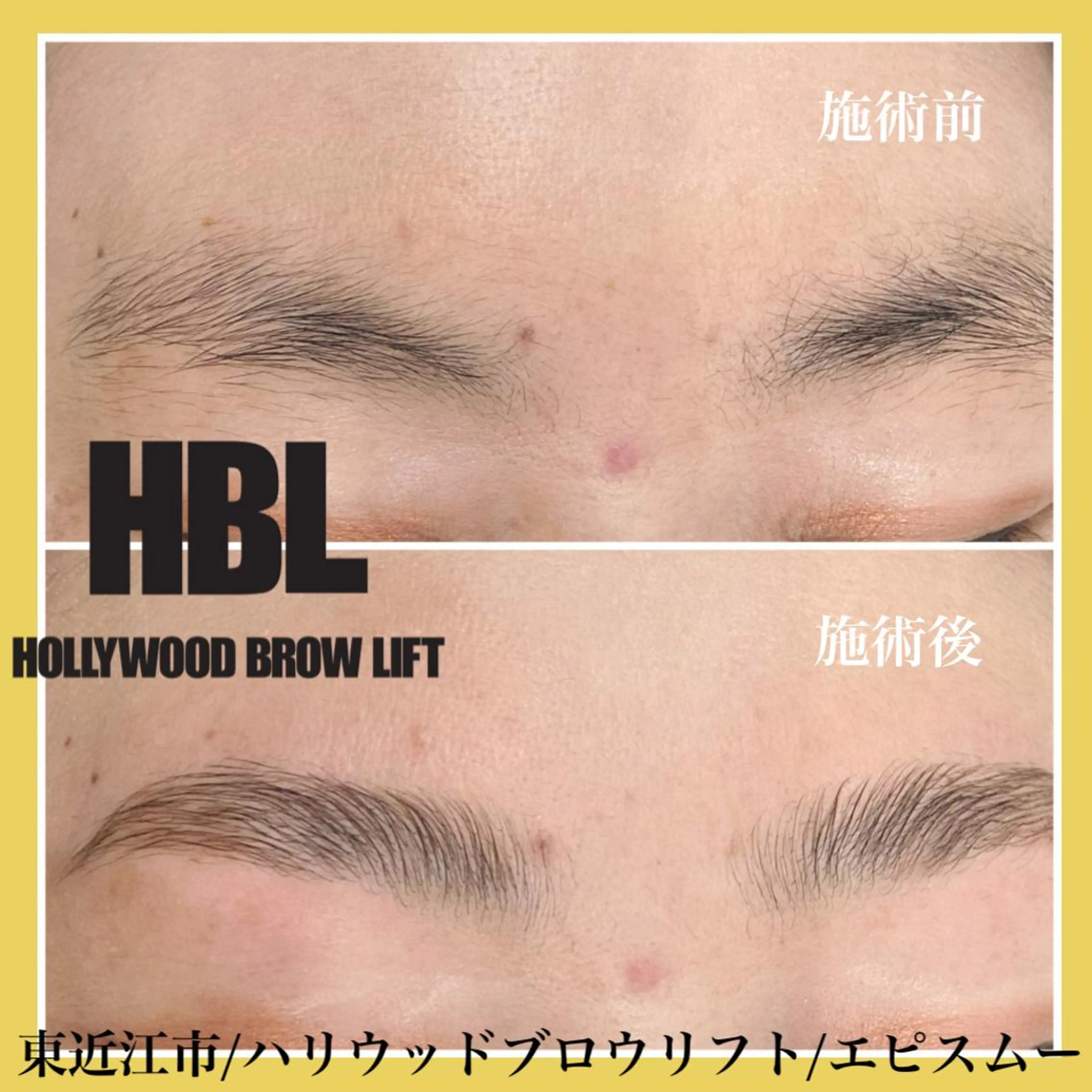 アイブロウ その他(アイブロウ) epismoo 脱毛/HBL/毛穴の眉毛・アイブロウイメージ