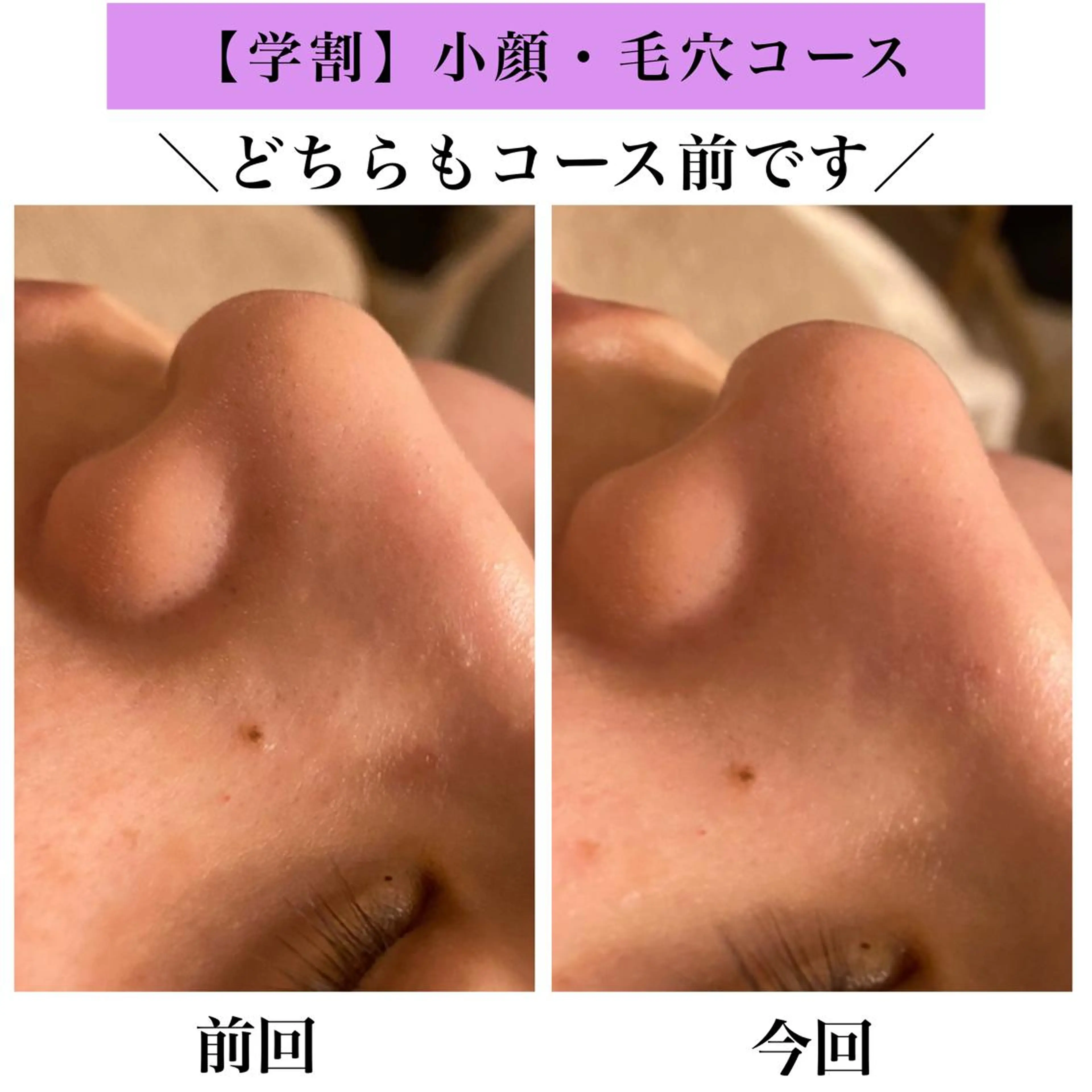 Bellesthe (ベルエステ)のエステ・リラクイメージ