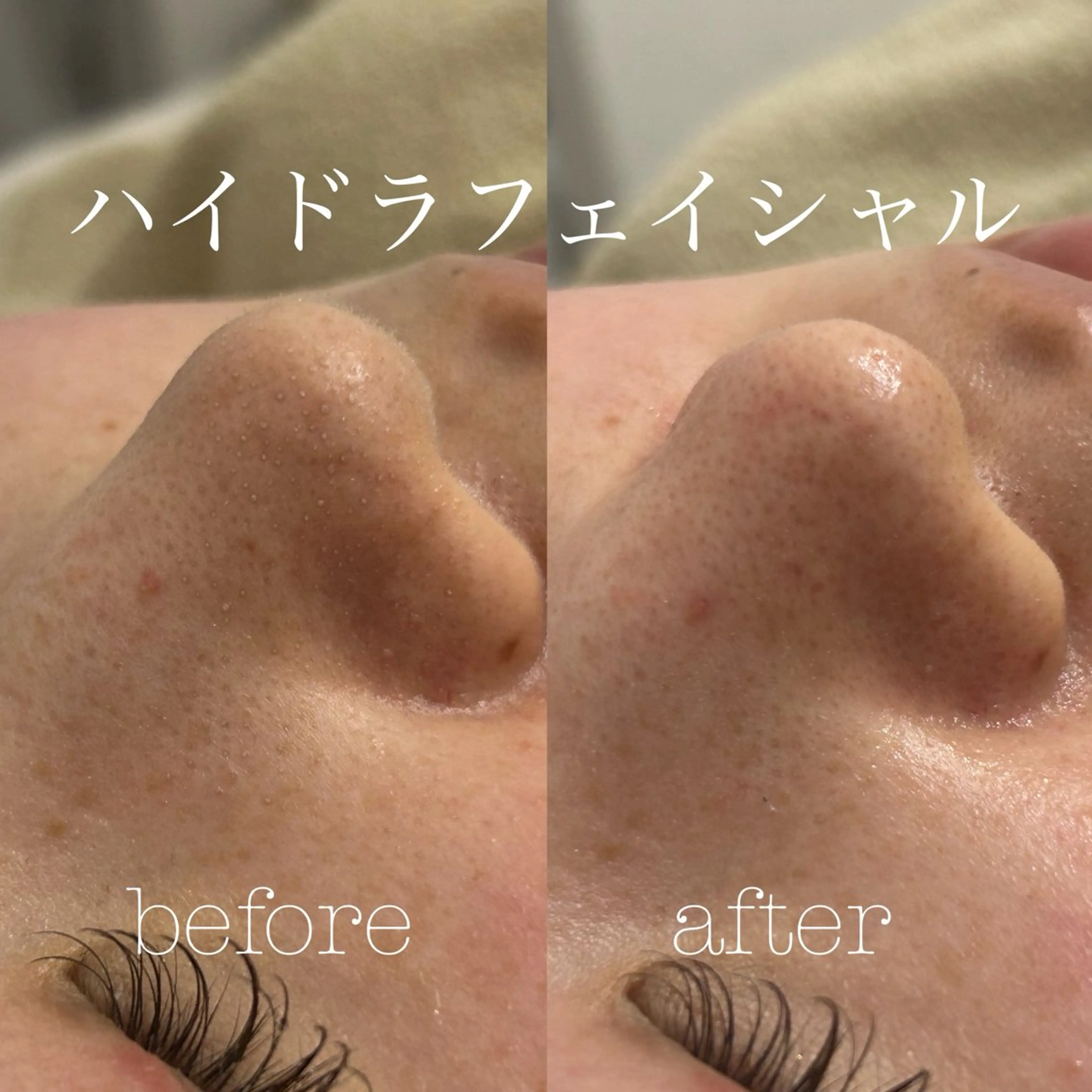エステ フェイシャルサロン CHIARA 荒田のエステ・リラクイメージ