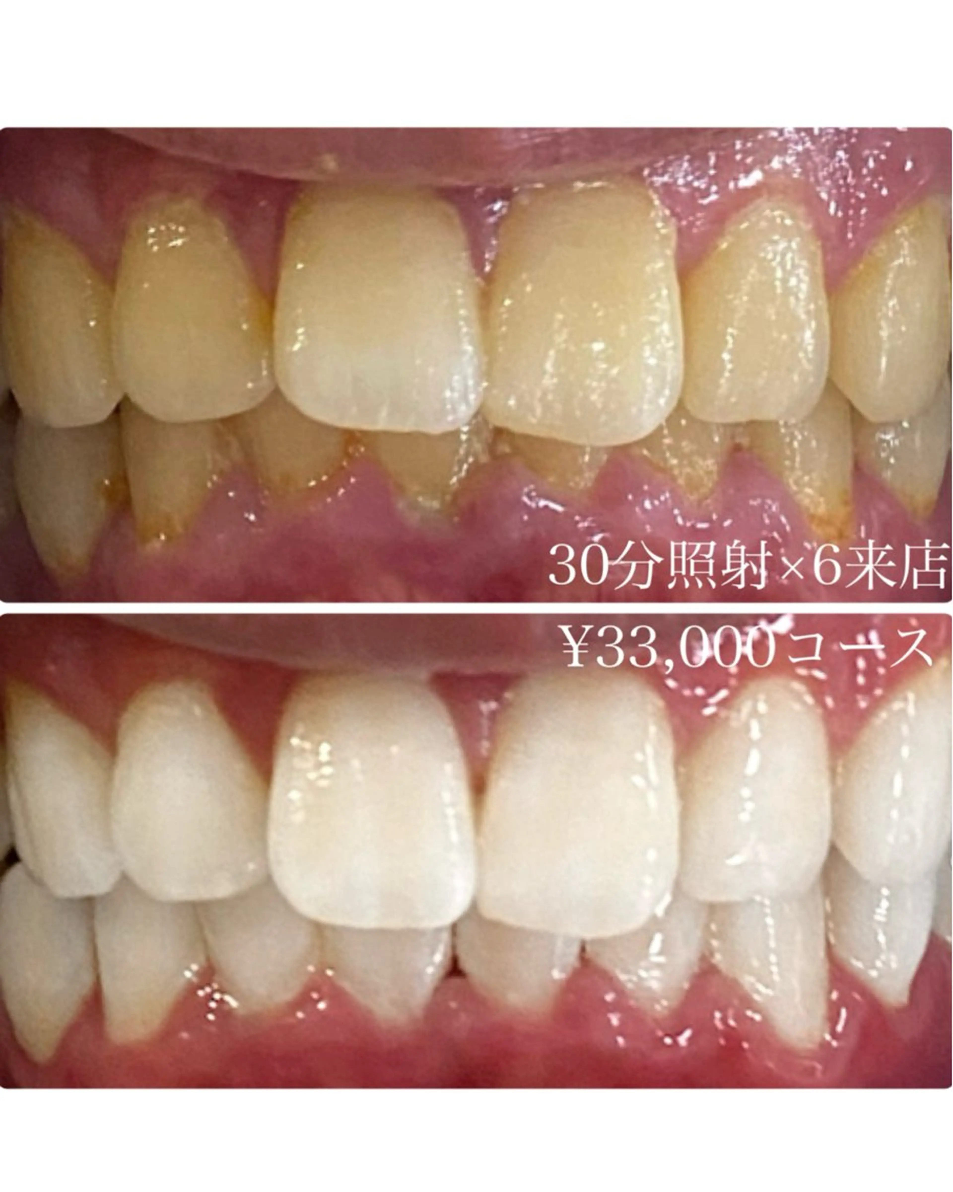 メンズ ホワイトニングルーム　川崎店所属・ホワイトニング ルーム　川崎店のその他イメージ