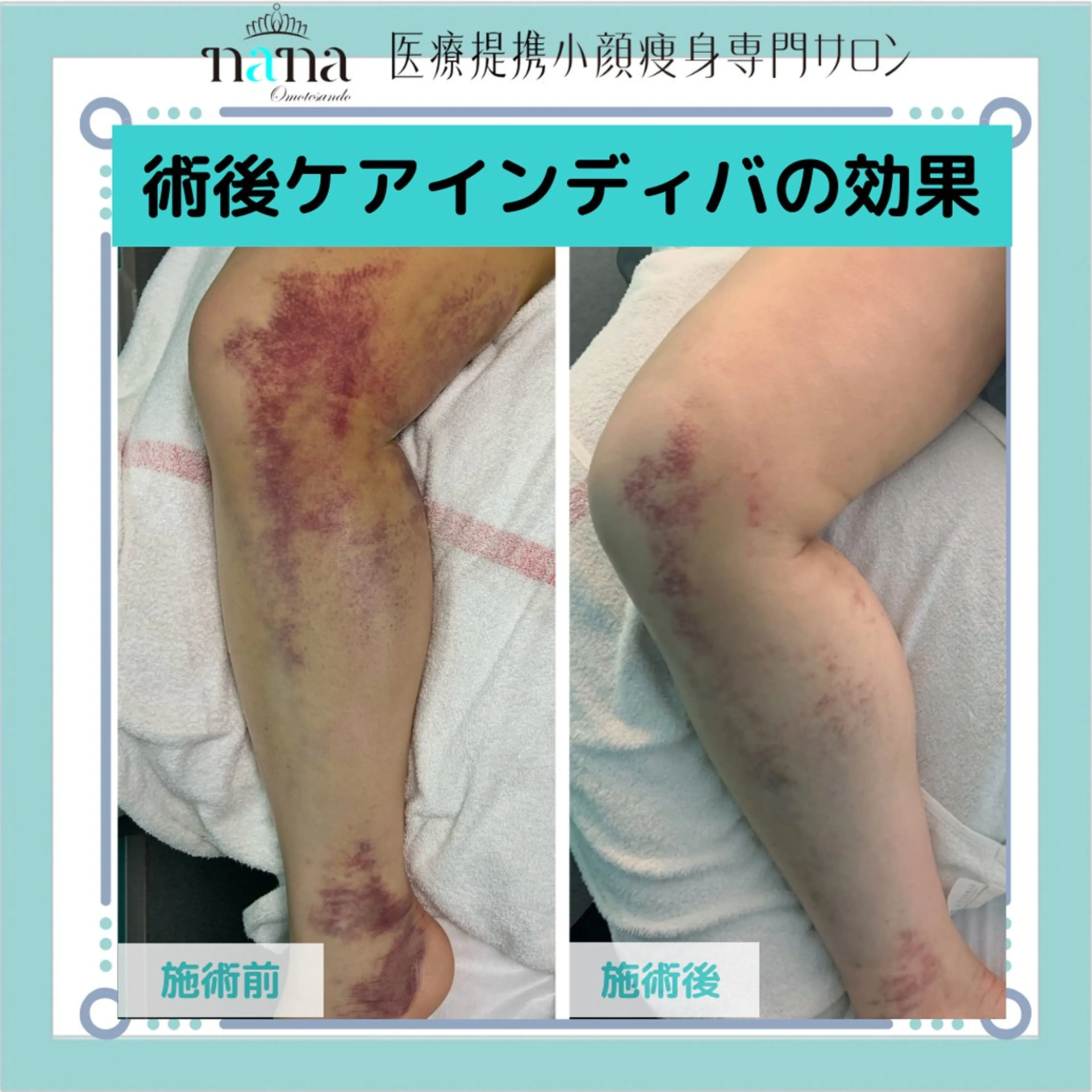 エステ リラク 小顔痩身インディバ Nana表参道のエステ・リラクイメージ