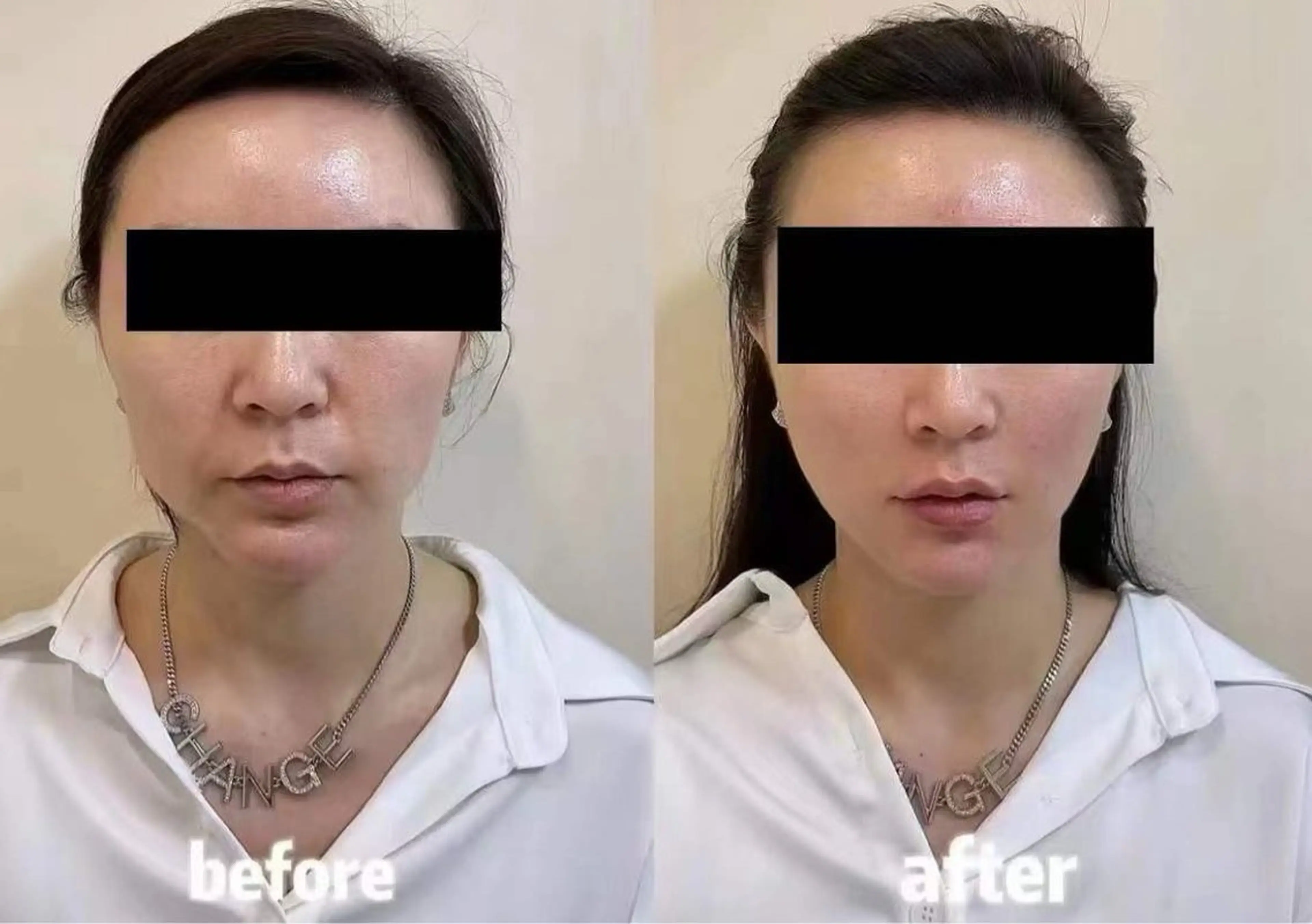 マツエク・マツパ 結婚式・ブライダル エステ aliaハイフ&水光ジェットサロン所属・aliaハーブ水光店 エステティシャン募集のエステ・リラクイメージ