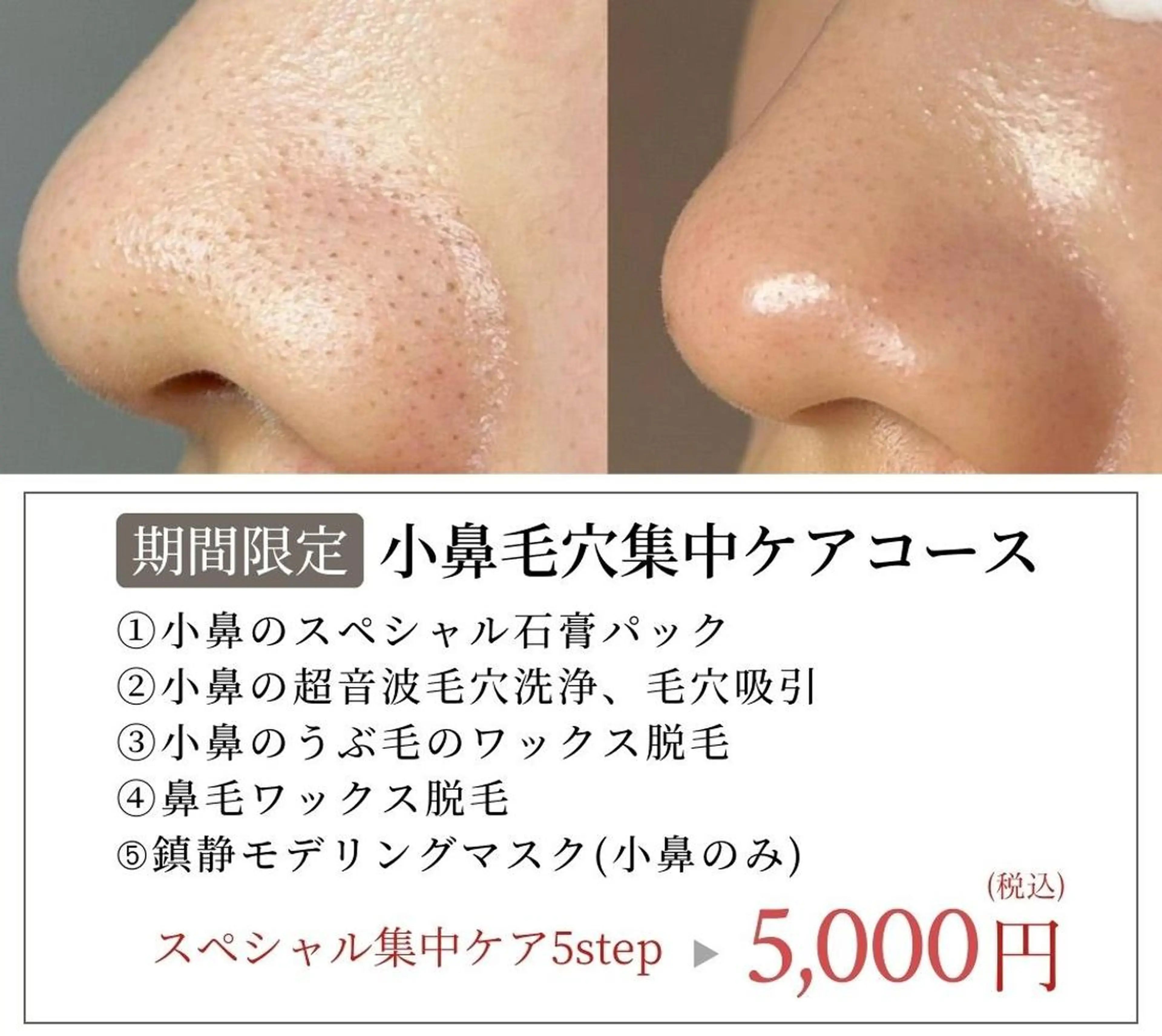 エステ Maple 【美容サロン】の眉毛・アイブロウイメージ