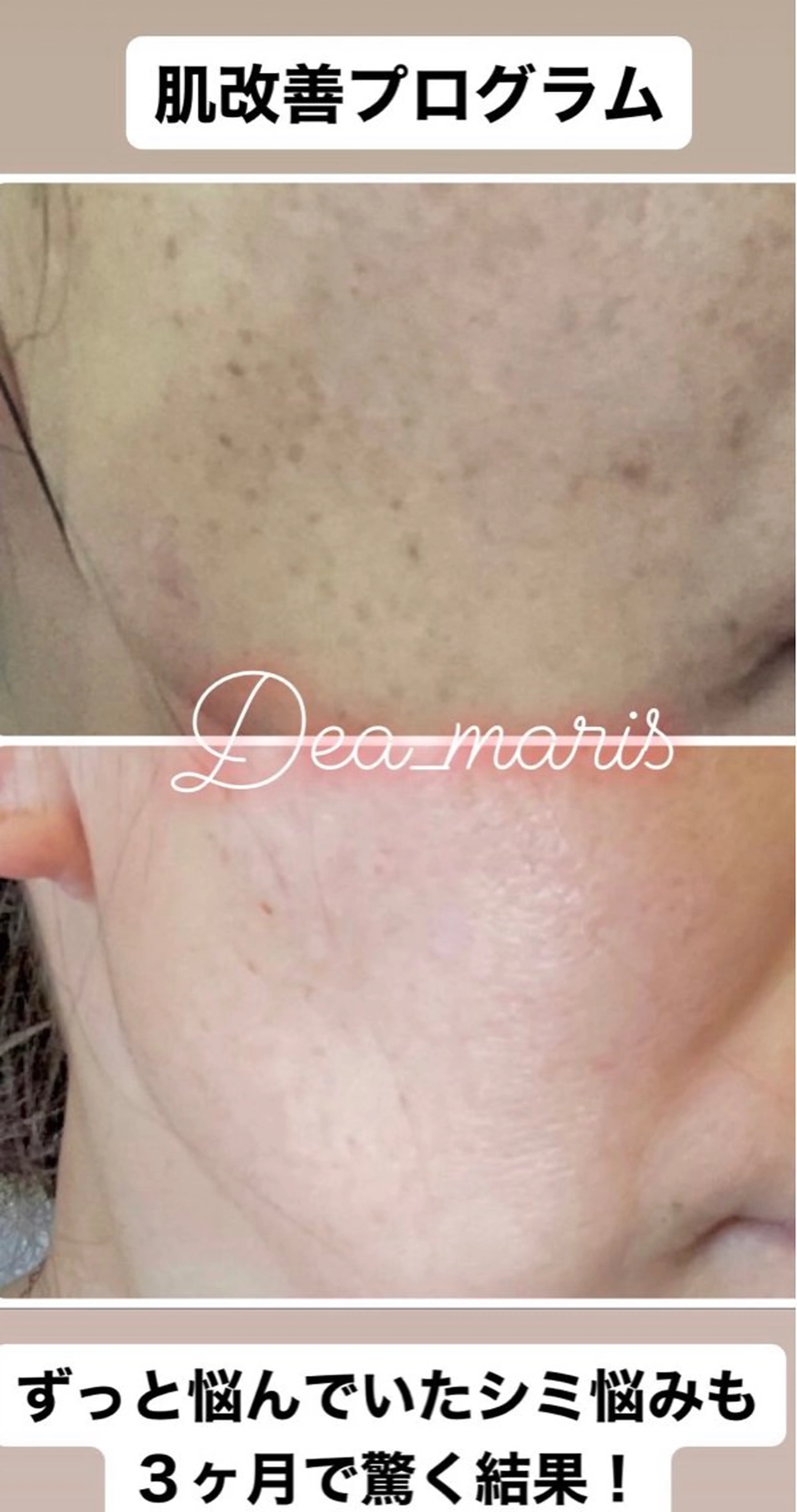 private salon  Dea_maris シュガーリング＆パーソナルボディケア所属・ダイエット難民が通う 10キロダイエットのその他イメージ