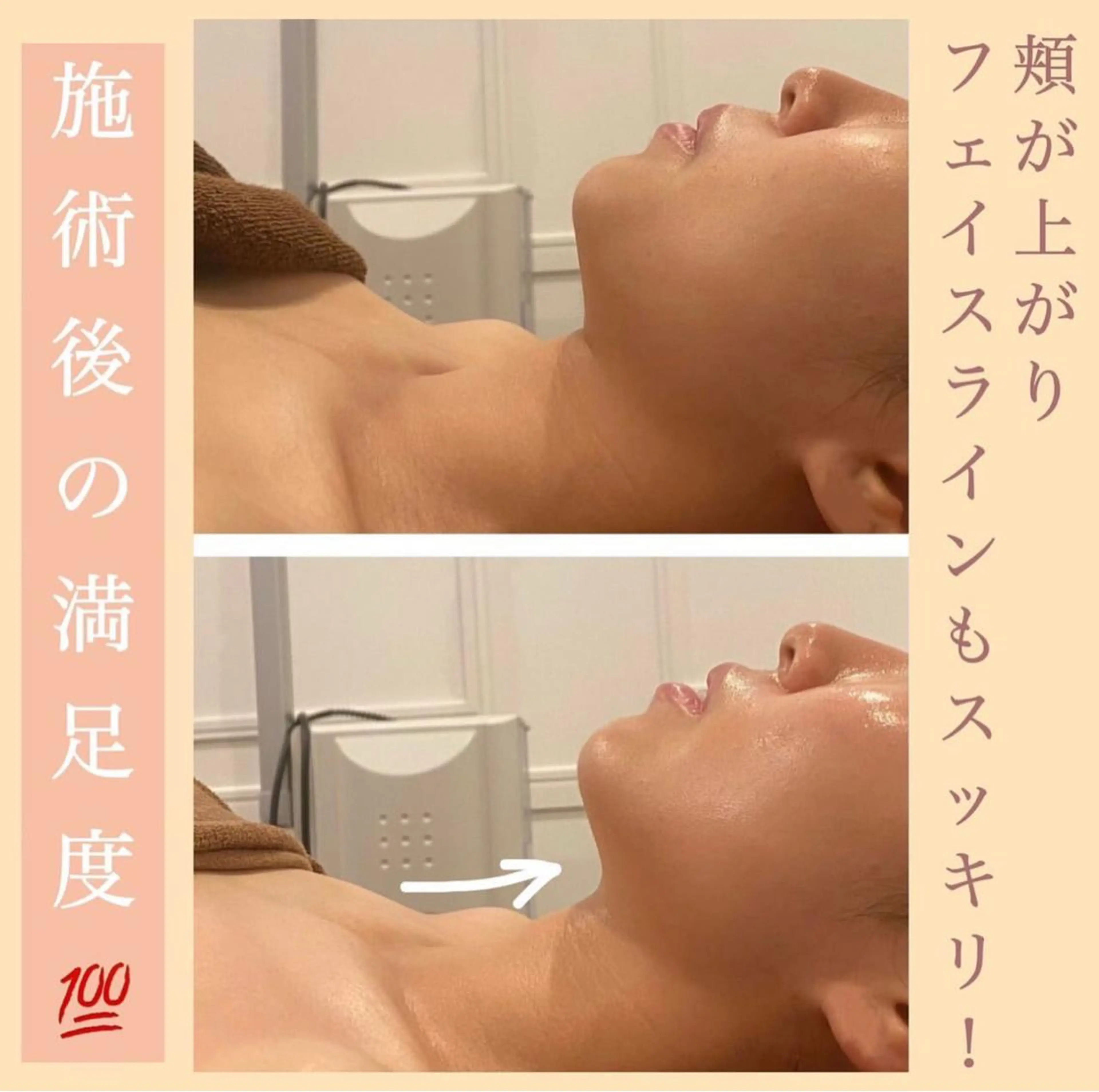 エステ Meow！～トラブル肌専門ピーリング＆脱毛サロン～所属・トラブル肌改善🏥 Meow！🫧🫧のエステ・リラクイメージ