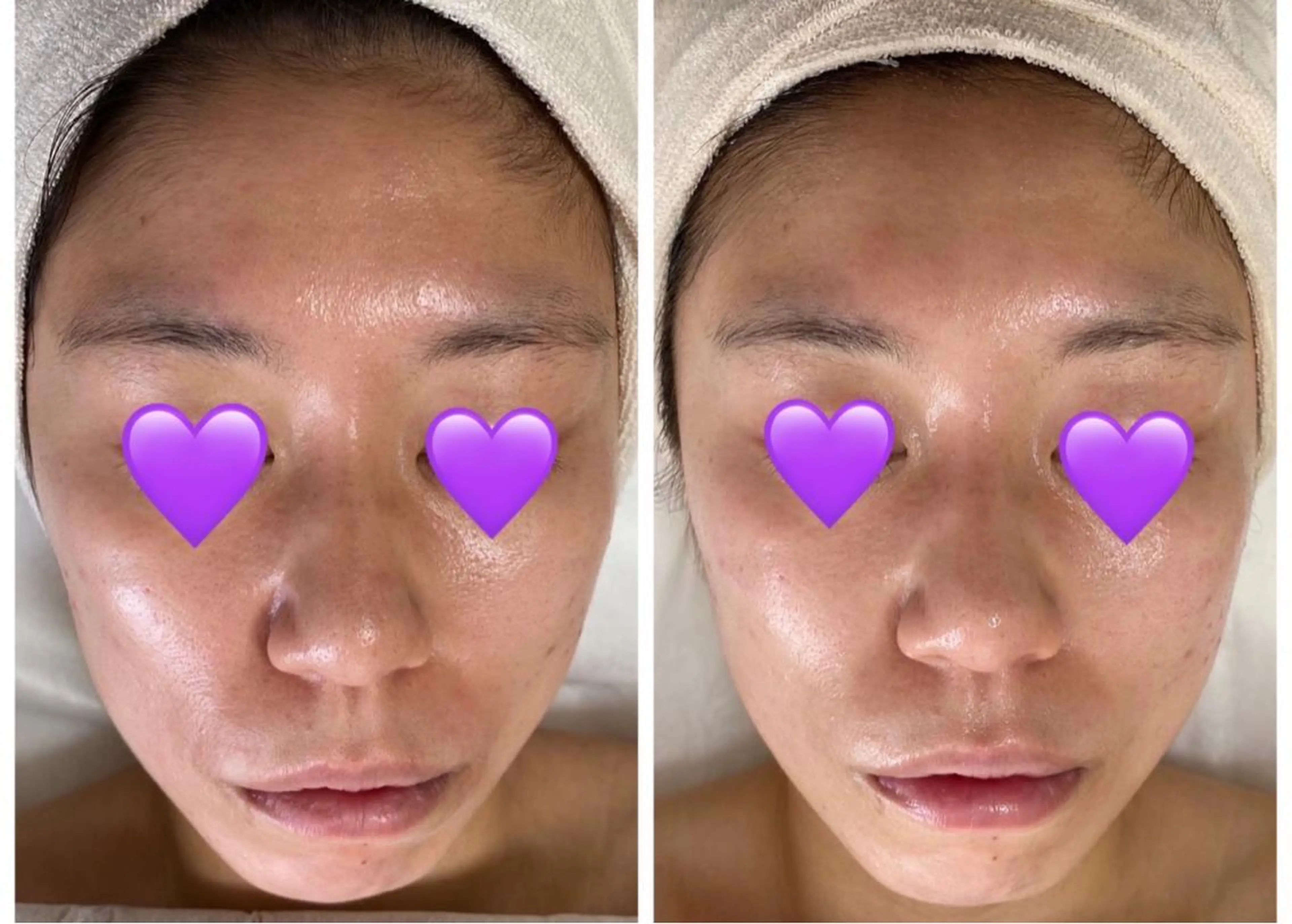 エステ De I'm トータルビューティーサロン所属・COCO beautyサロンのエステ・リラクイメージ